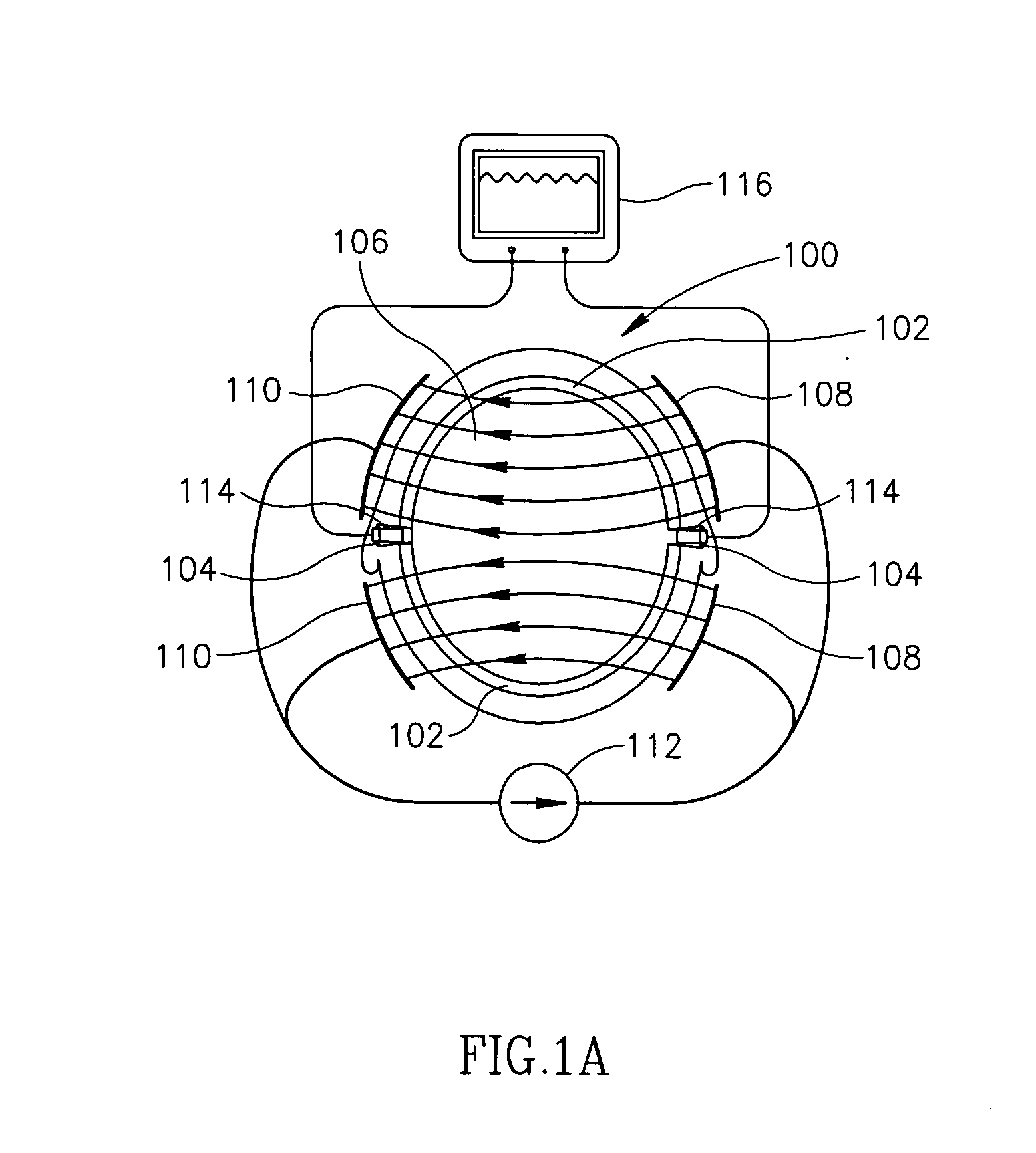 Device for monitoring blood flow to brain
