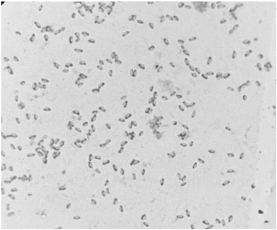 Brevibacillus laterosporus for inhibiting riziocotinia solani, and application thereof