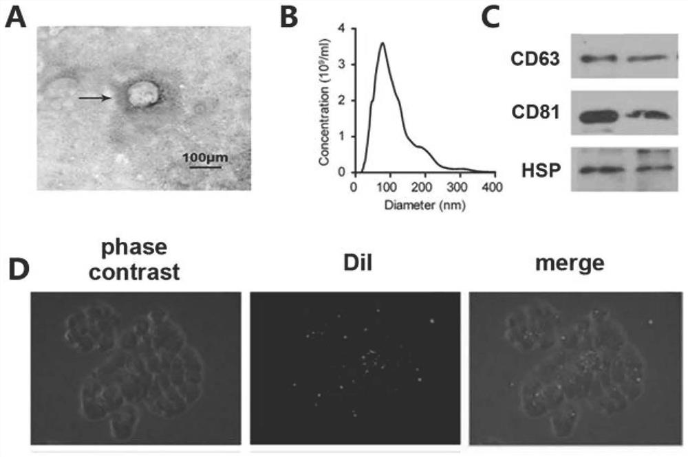 Research method of protection mechanism of BMSC-Exo on high glucose induced HK2 cell damage