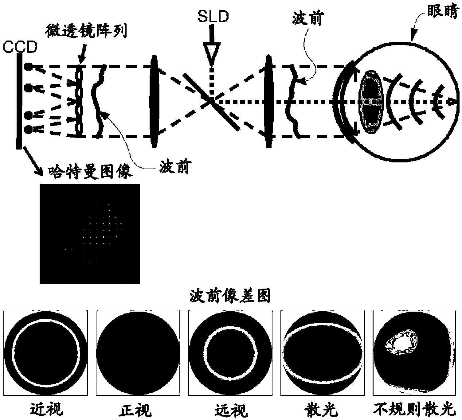 Contact lens for correction of irregular astigmatism