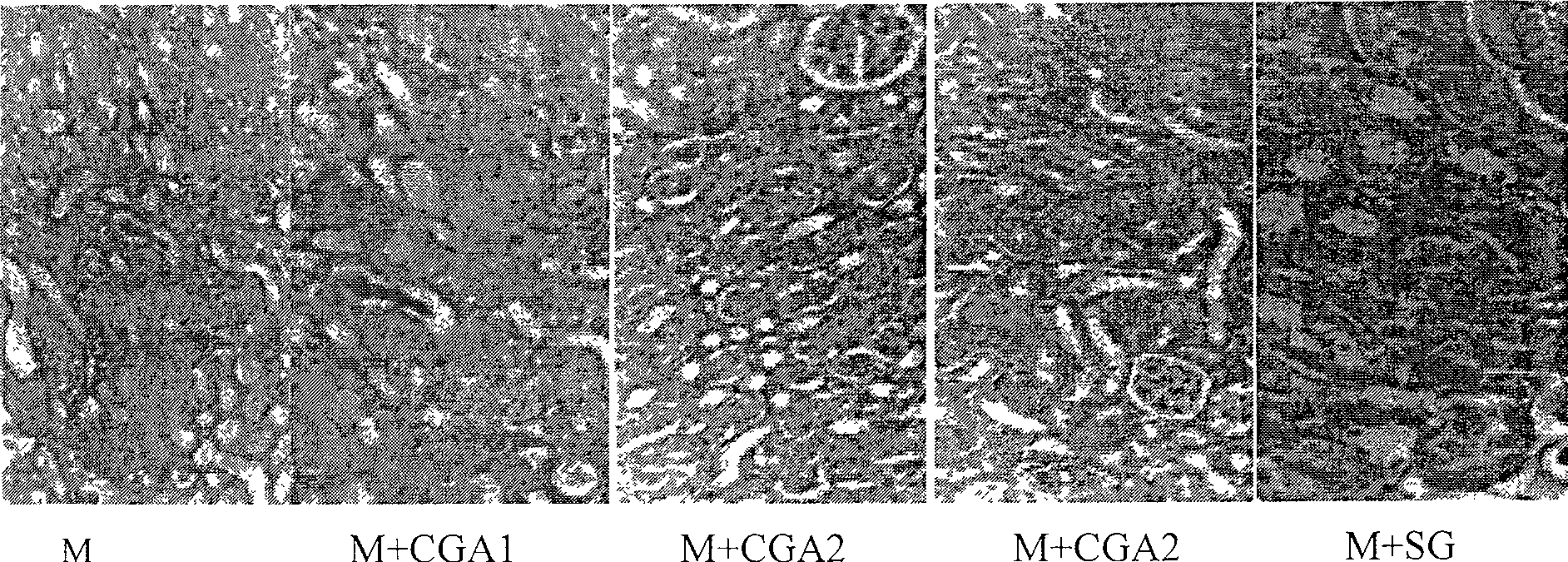 Application of chlorogenic acid for preparing medicine to treat diabetes complications