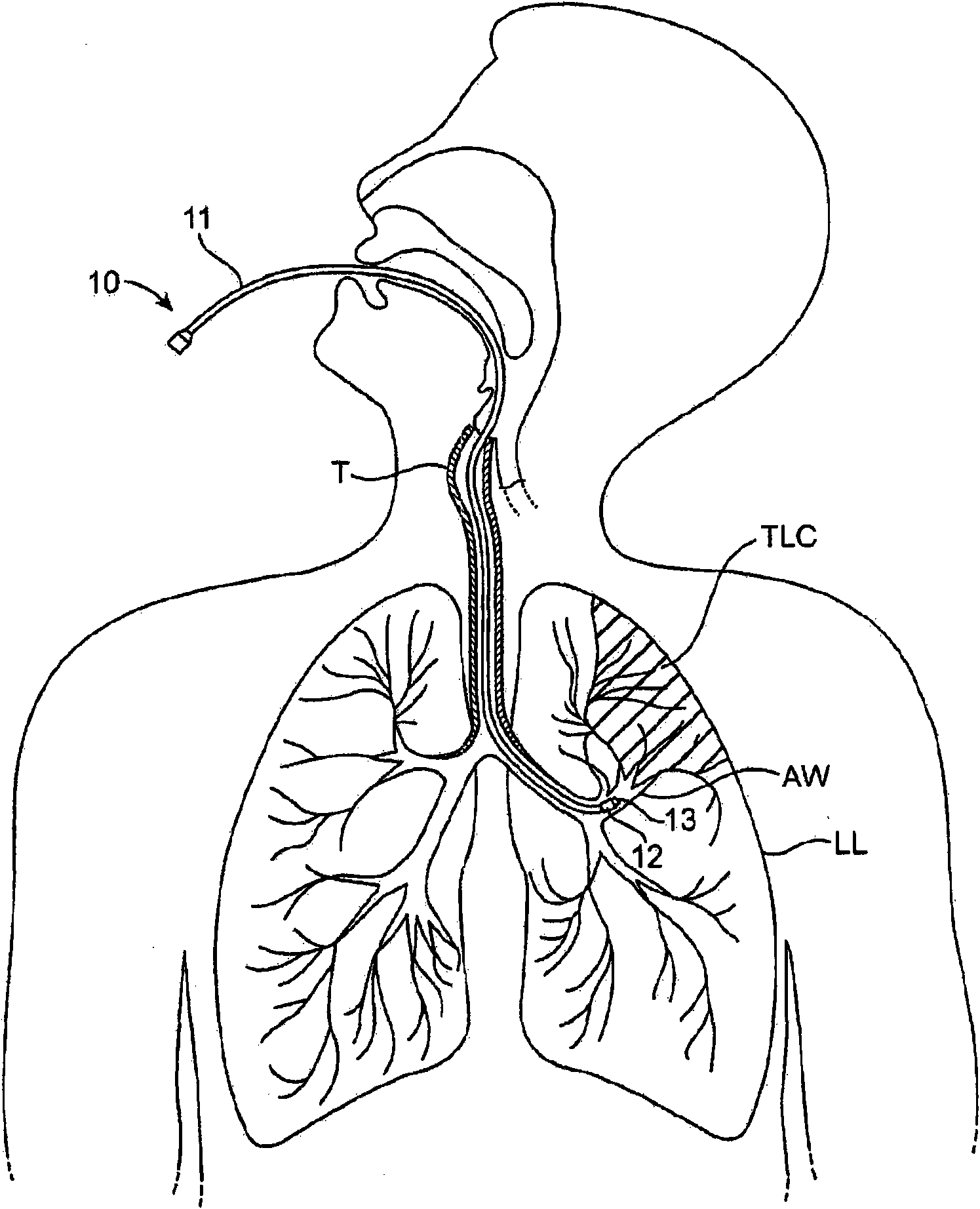 Methods and systems for assessing lung function and delivering therapeutic agents