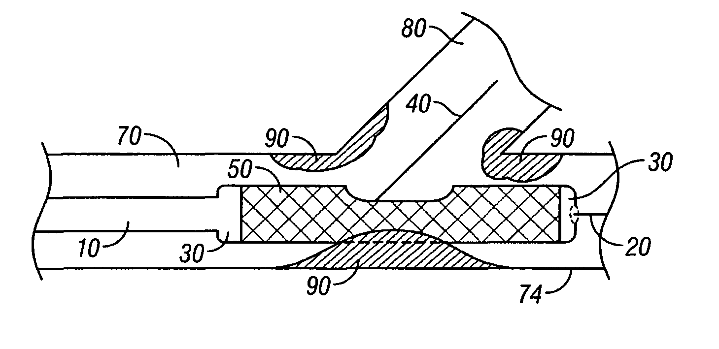 Bifurcation stent and delivery system