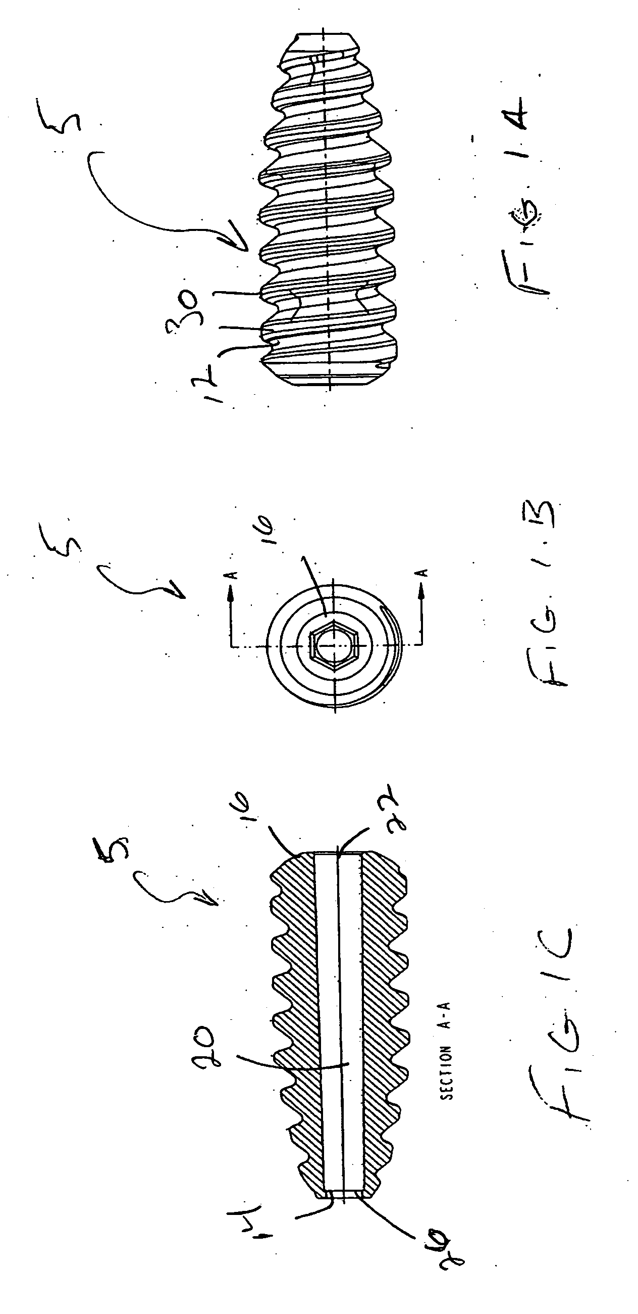 Method of performing anterior cruciate ligament reconstruction using biodegradable interference screw
