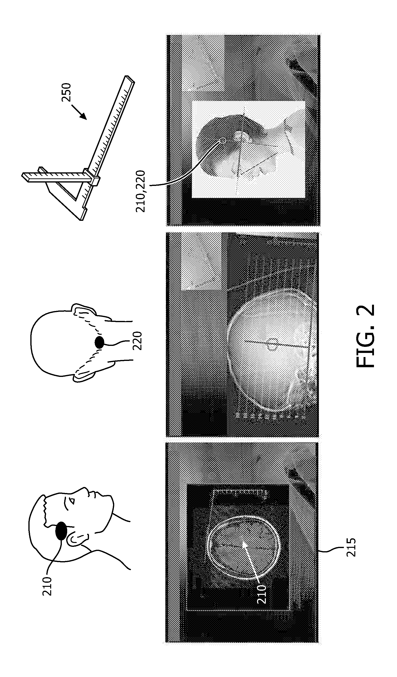 System and method for ultrasound and computed tomography image registration for sonothrombolysis treatment