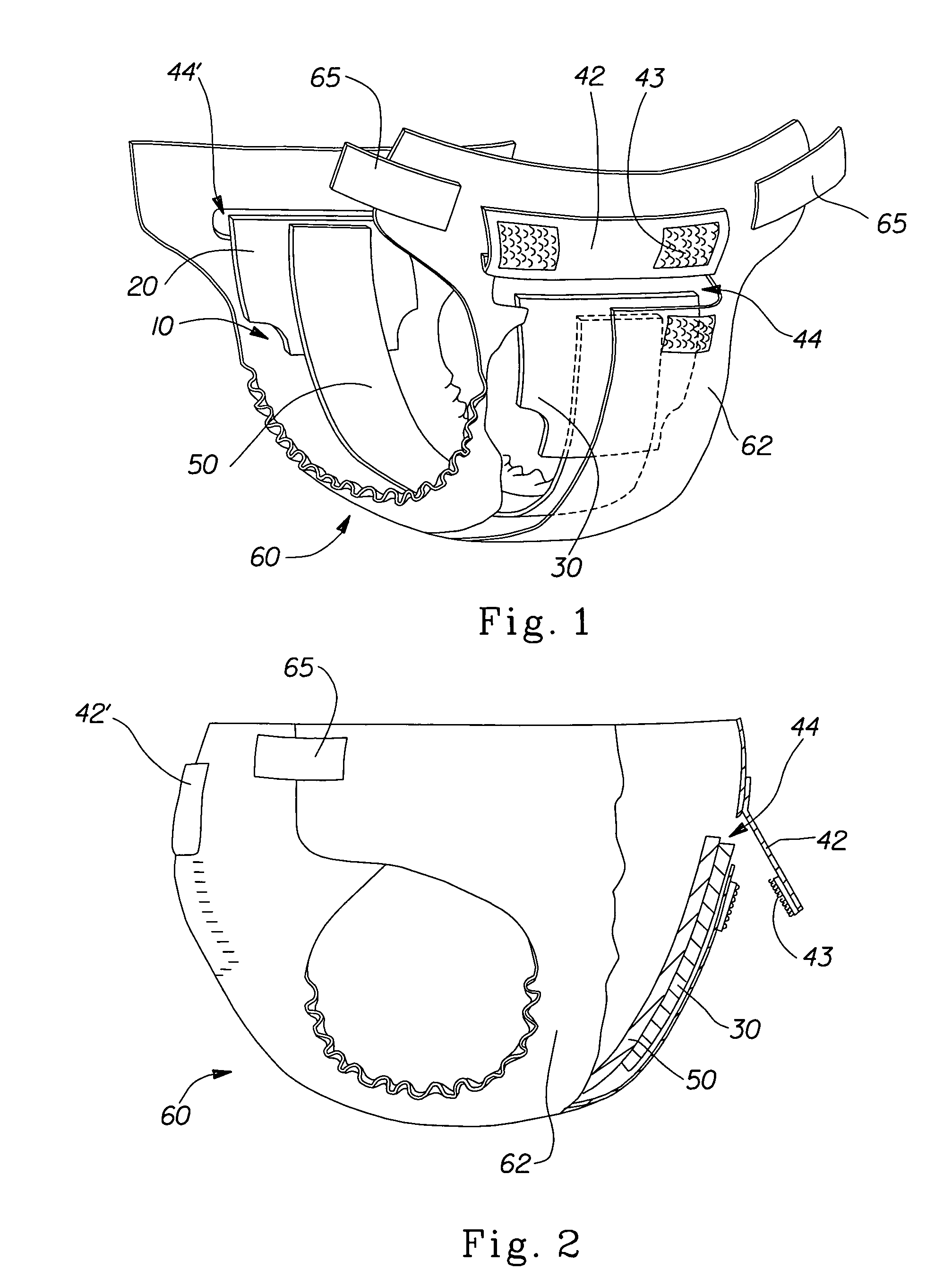 Absorbent articles having removable components