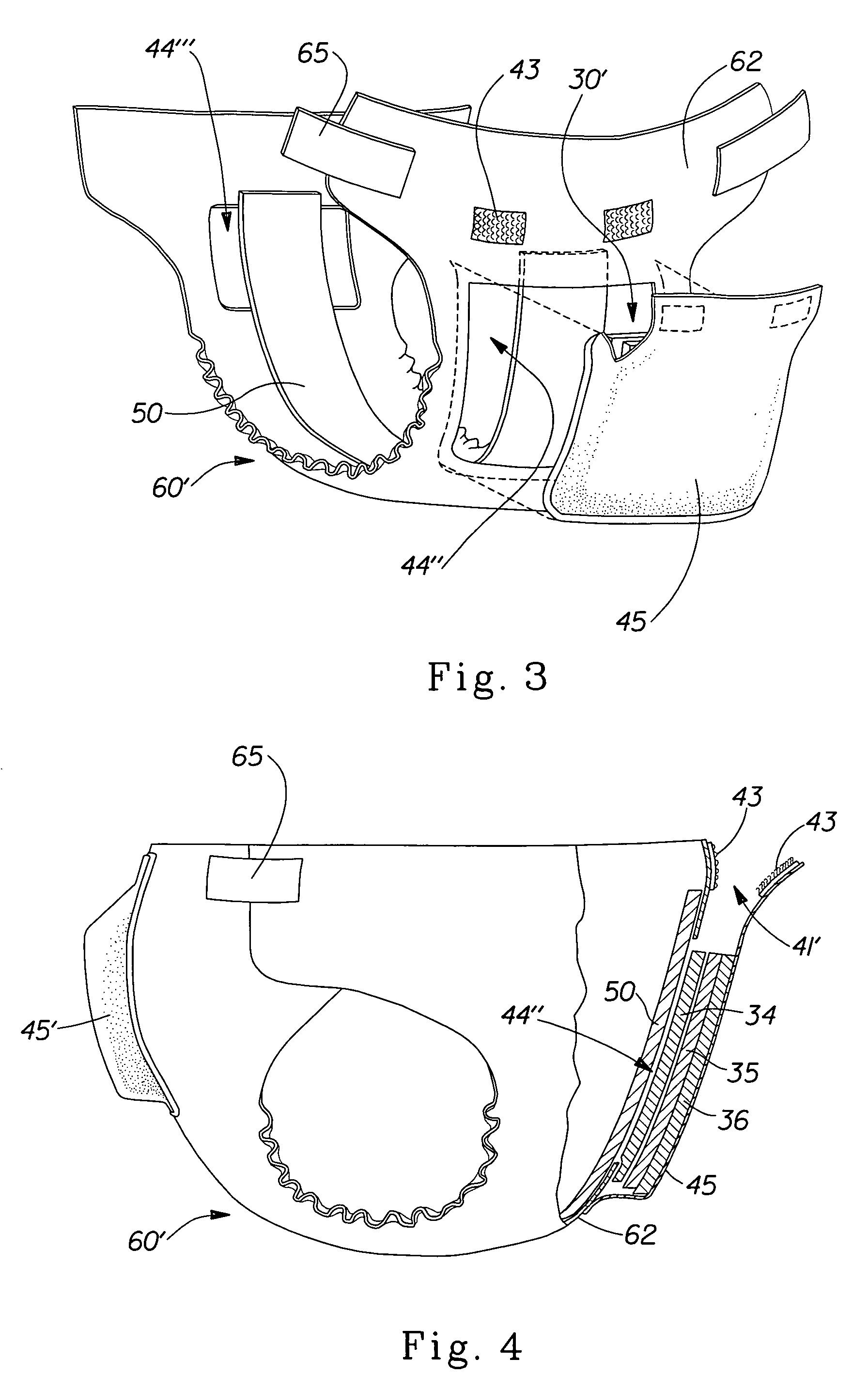 Absorbent articles having removable components