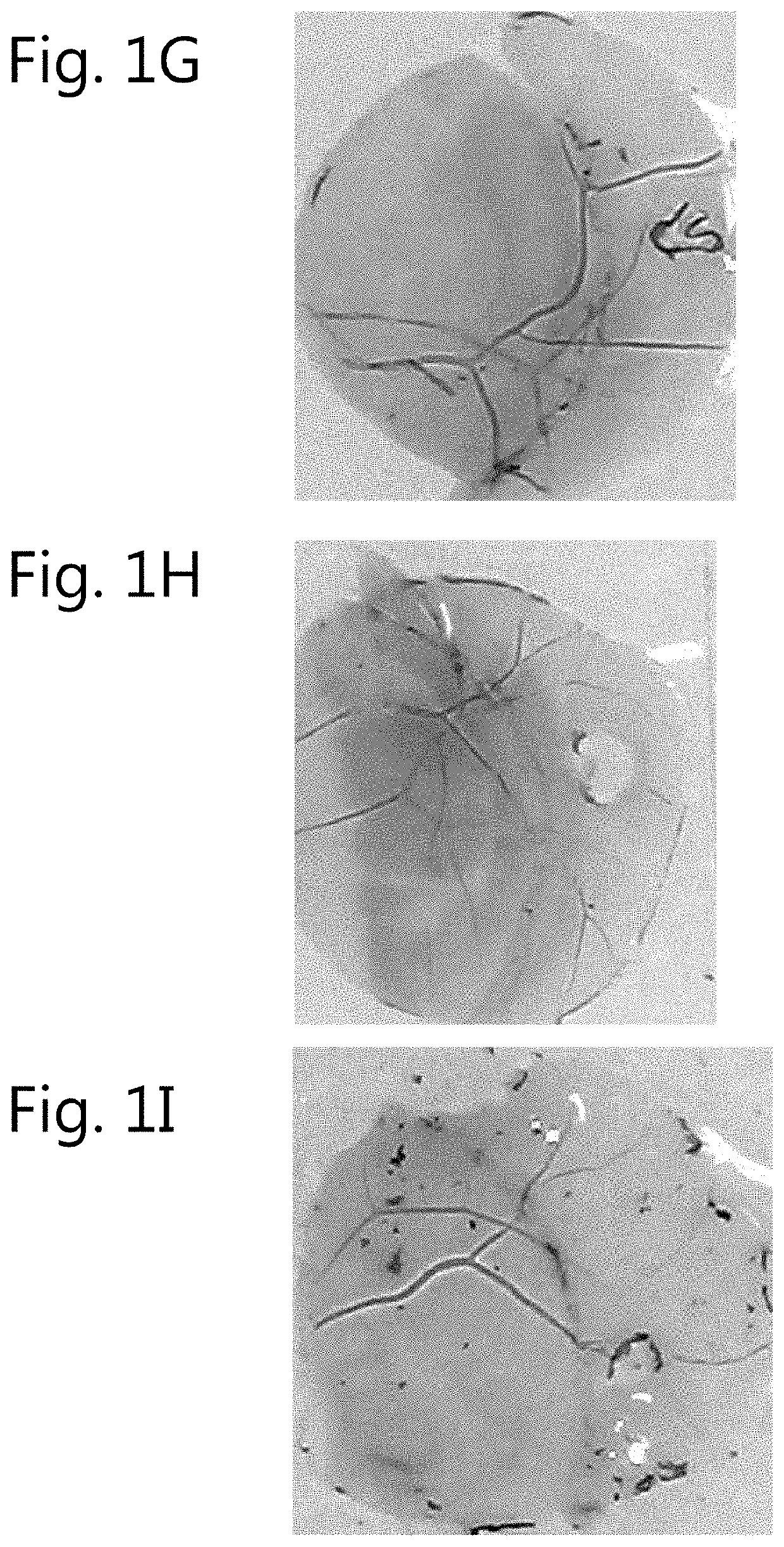 Ophthalmic dye composition