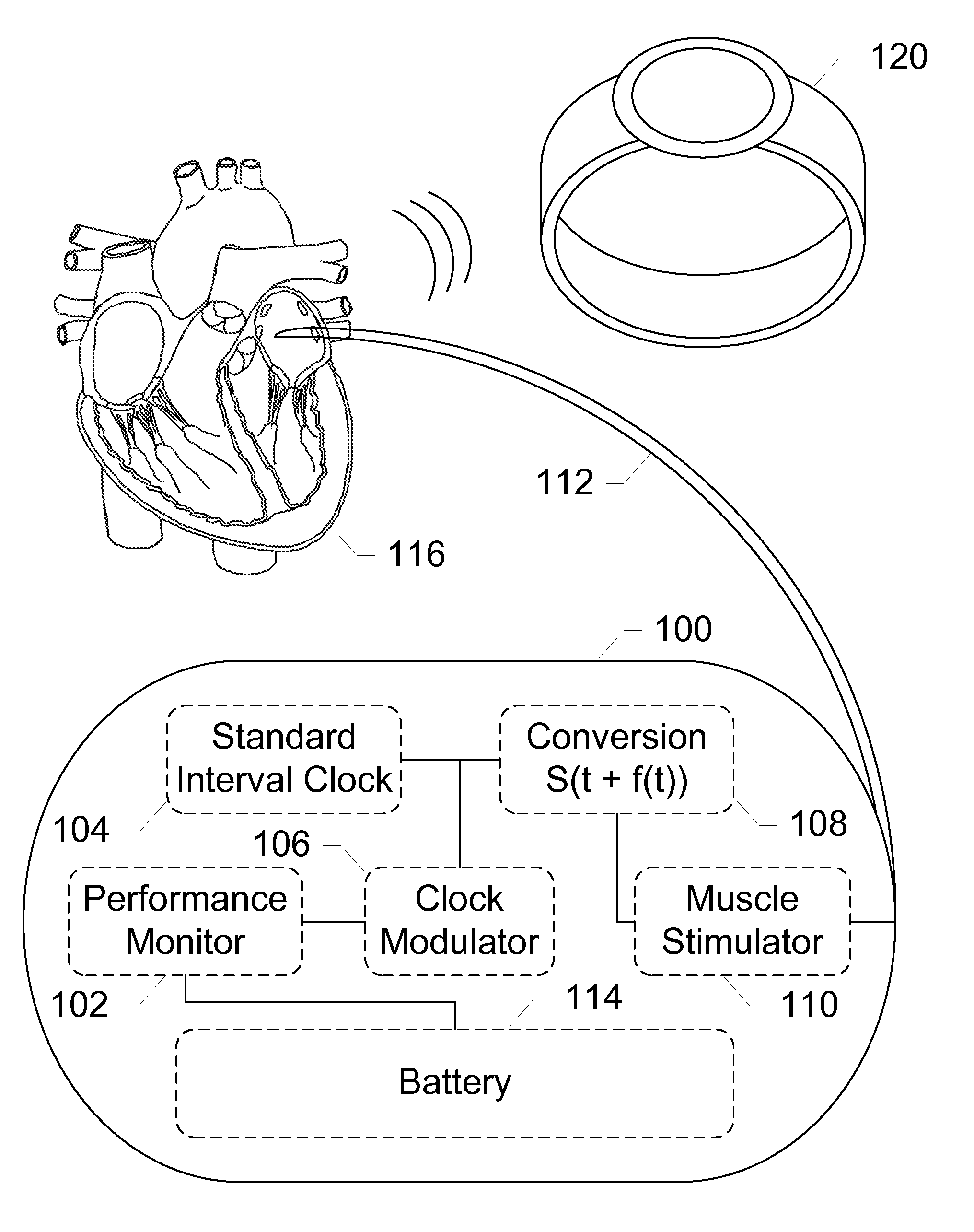 Mobile applications and methods for conveying performance information of a cardiac pacemaker