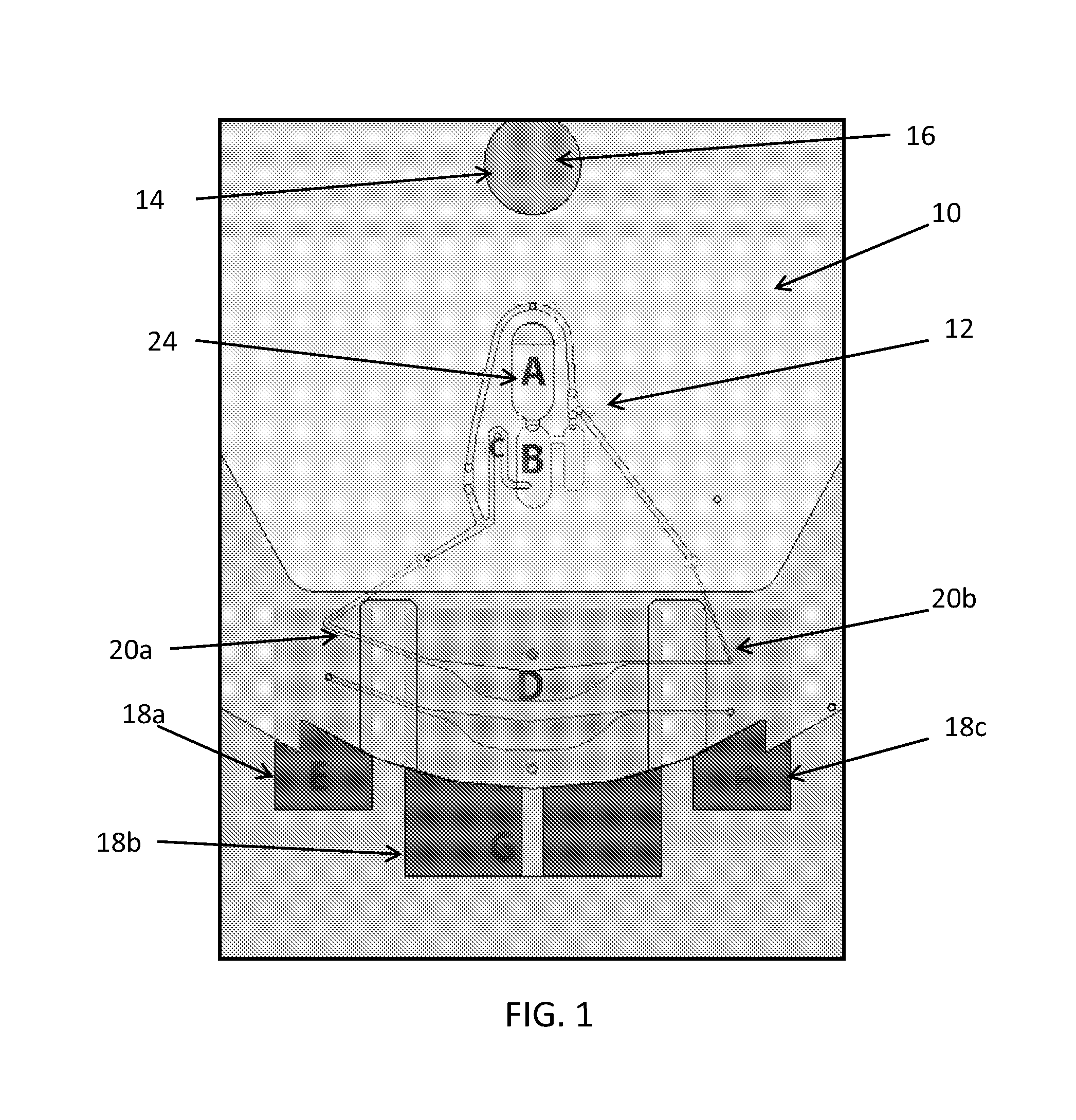 Centrifugal microfluidic system for nucleic acid sample preparation, amplification, and detection