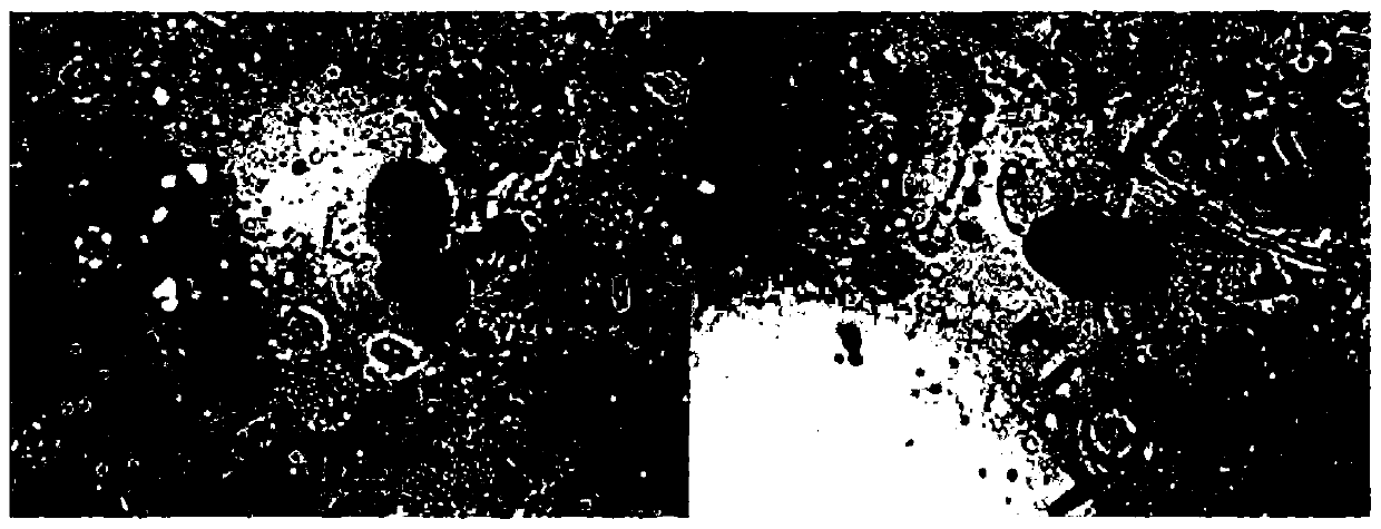 The preparation method of the protoplast of Gracilaria gracilaria in Chile