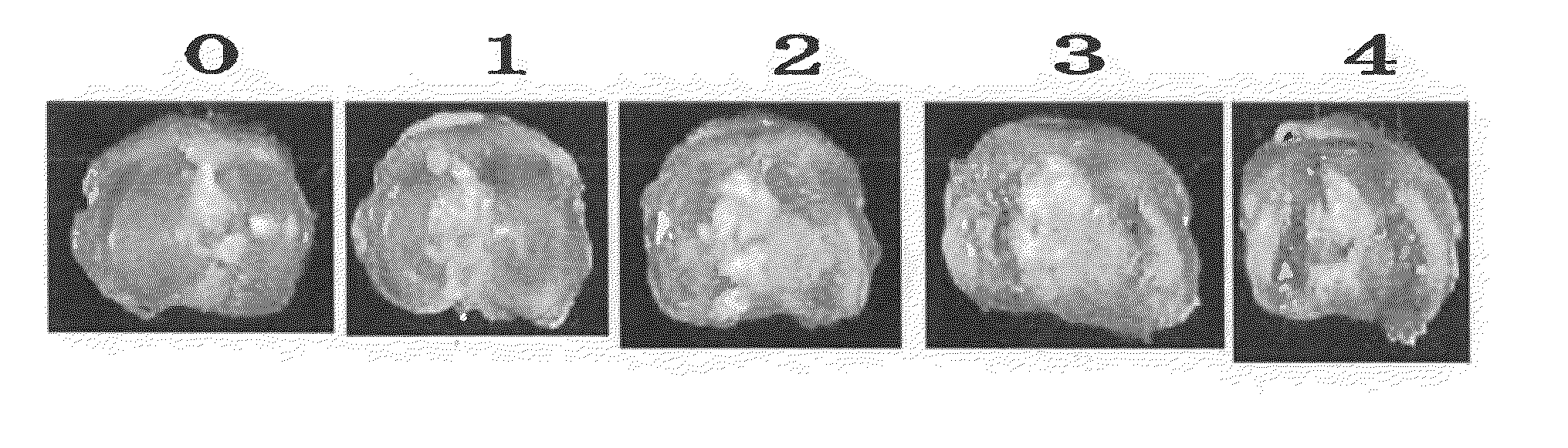 Pain remedy containing rock inhibitor