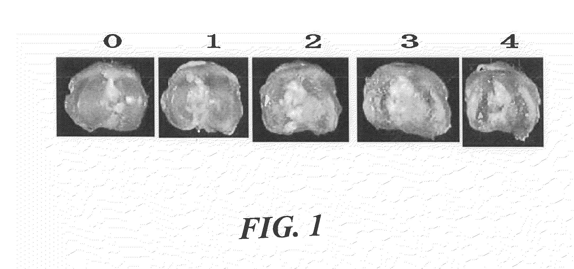 Pain remedy containing rock inhibitor