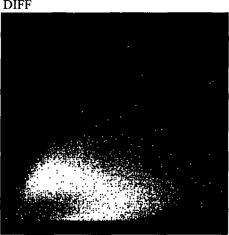 Five-classification leucocyte simulacrum particle, method for preparing same, and quality control substance and calibration substance containing same