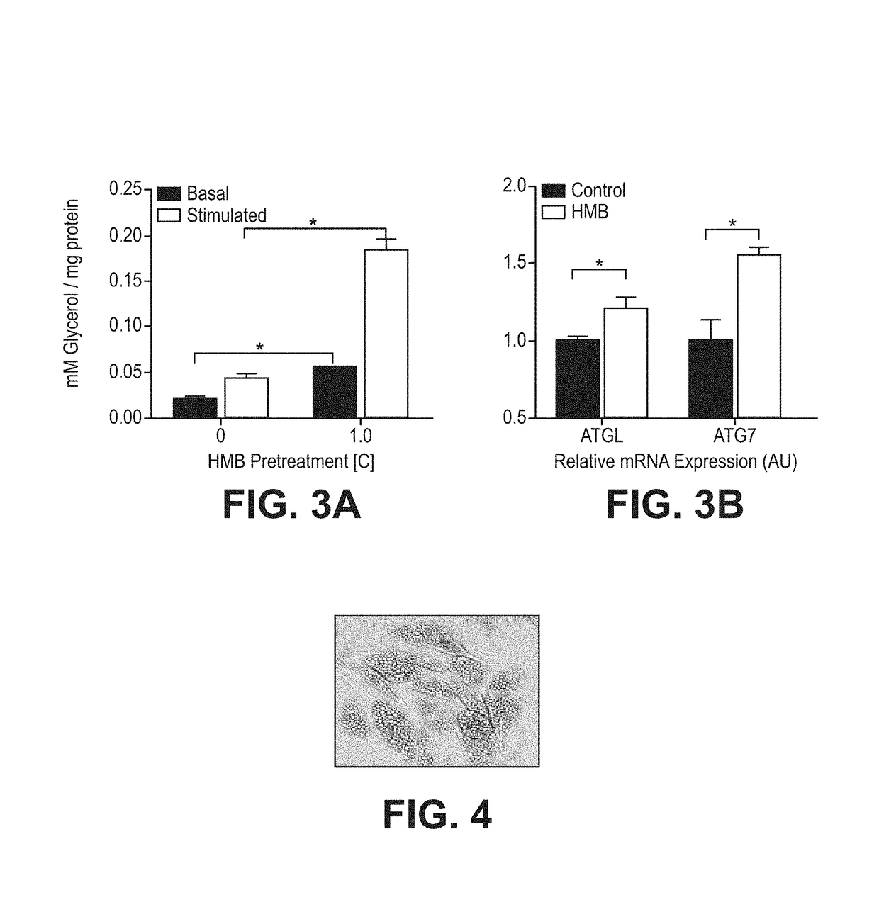 Compositions and methods of use of β-hydroxy-β-methylbutyrate (HMB) for modulating autophagy and lipophagy