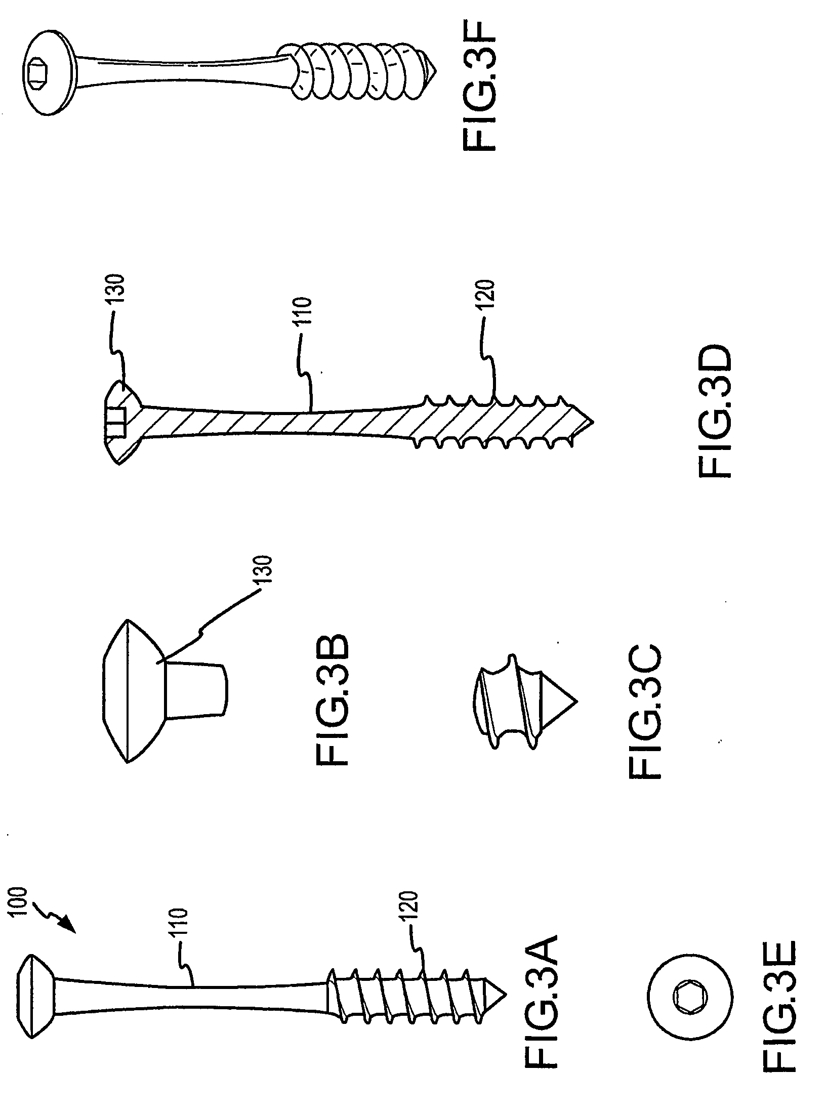 Osteosynthetic Implants and Methods of Use and Manufacture