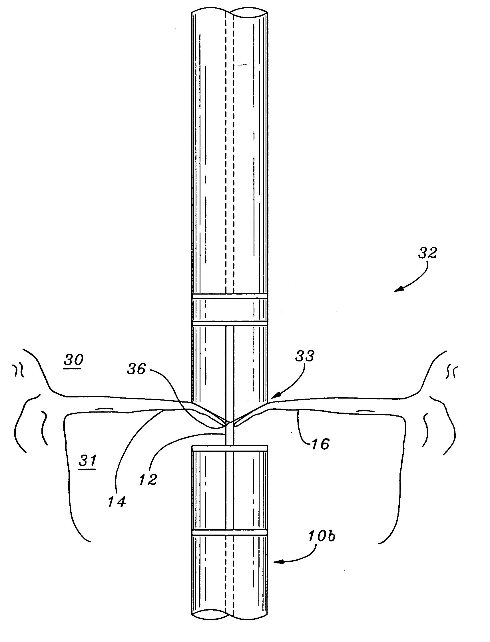 Method and system for tissue repair using dual catheters