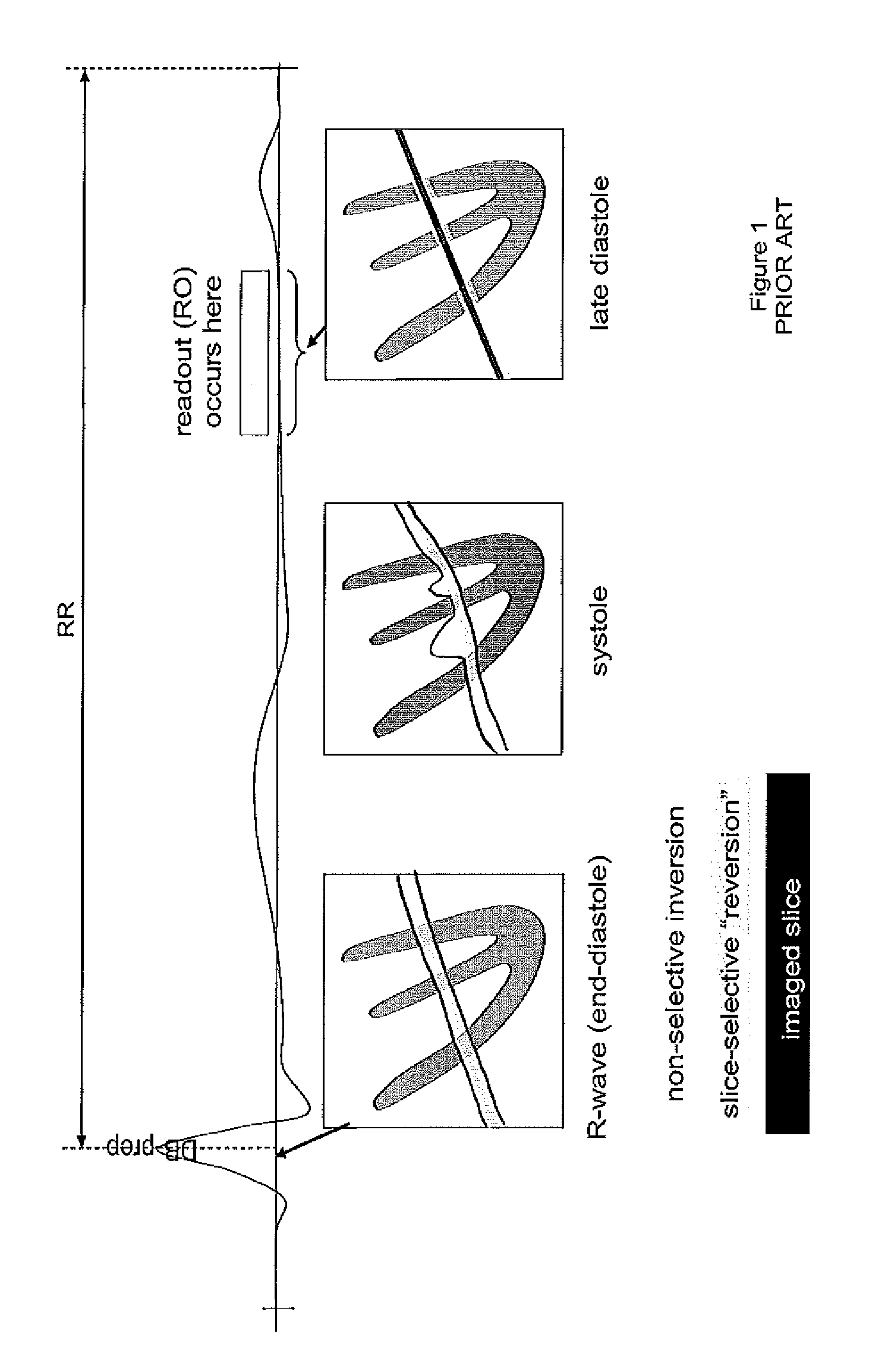 System for automated parameter setting in cardiac magnetic resonance imaging