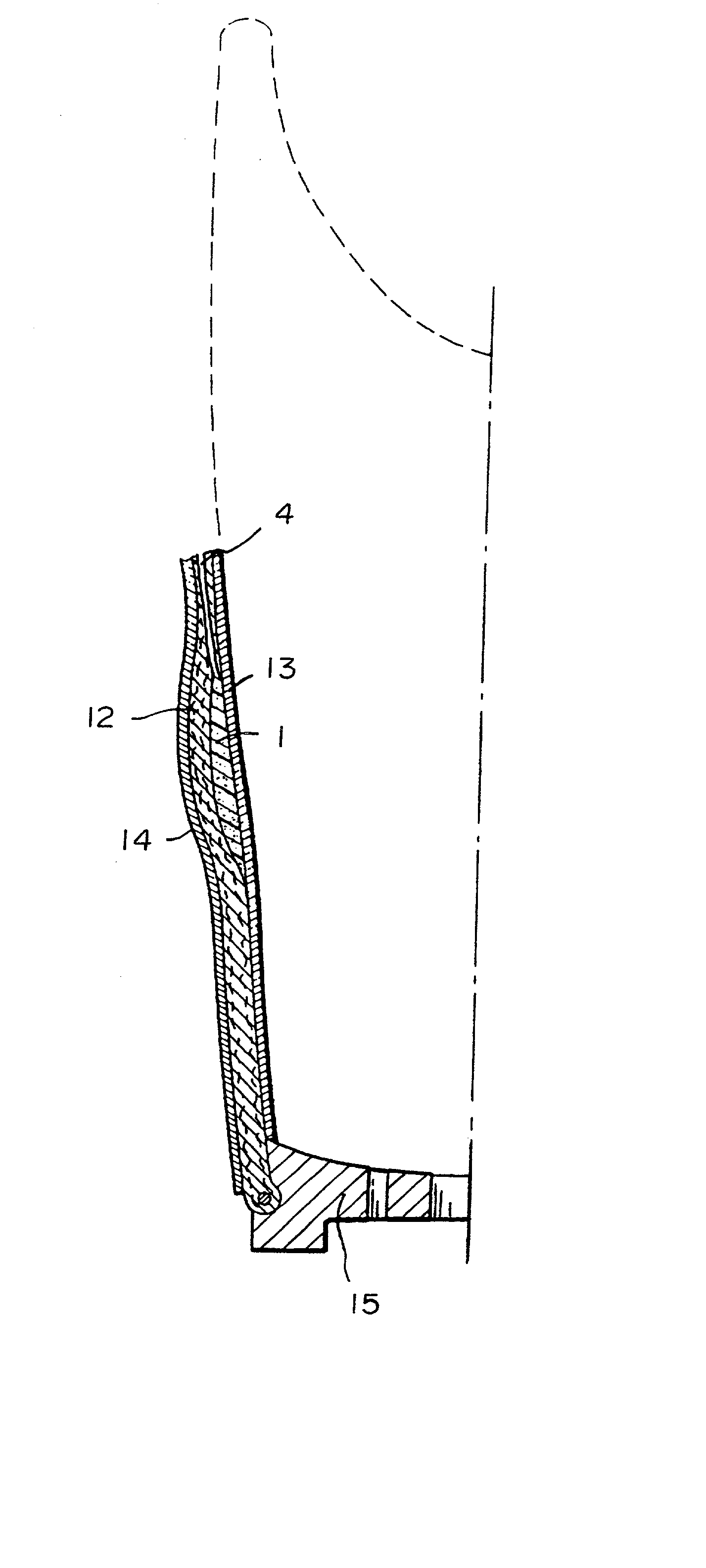 Artificial limb socket containing volume control pad