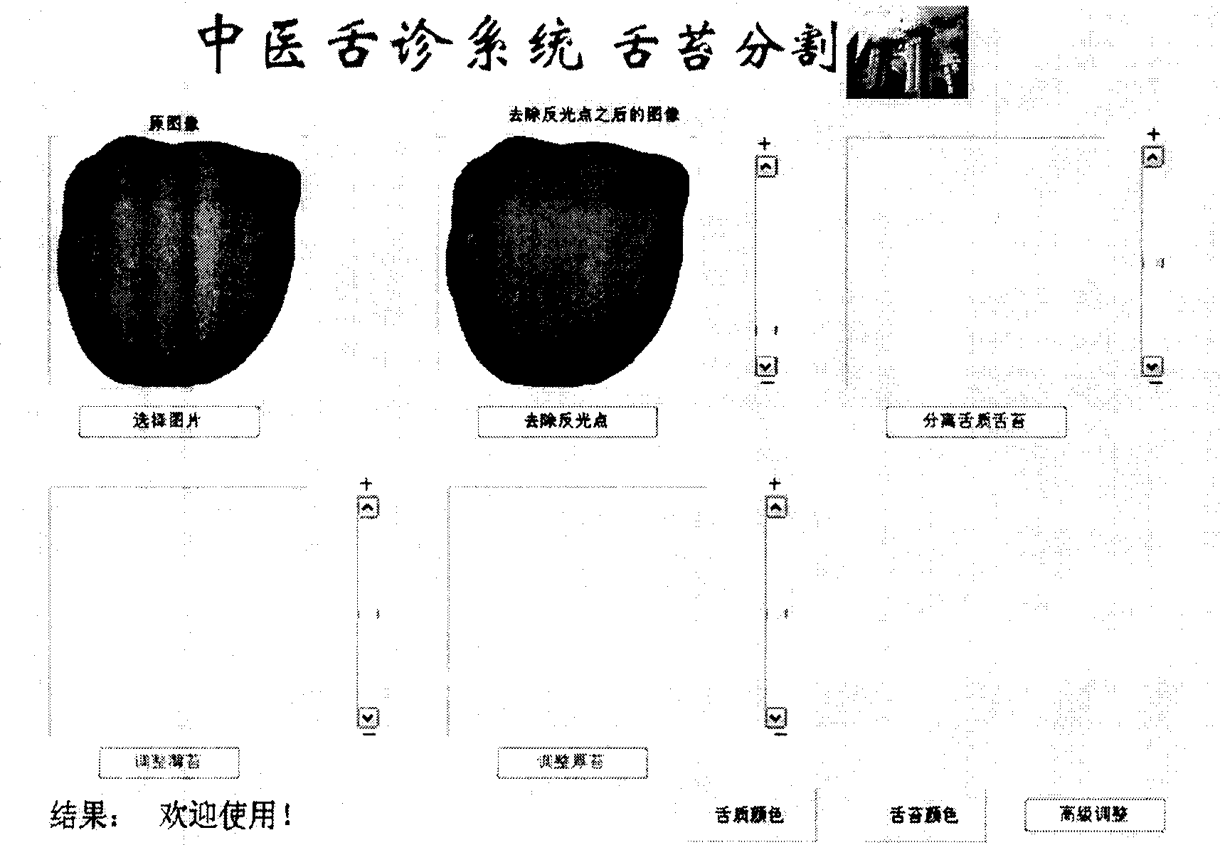 Coated tongue division and extracting method for colored digital photo of tongue