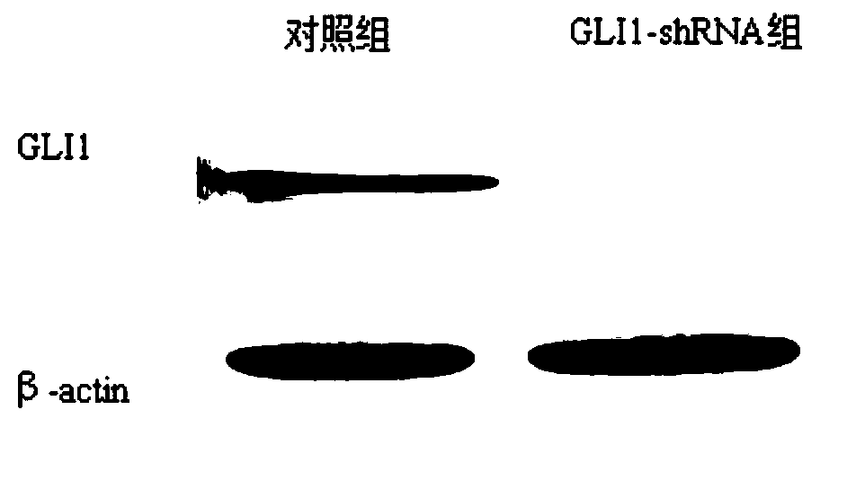GLI1-shRNA and application thereof