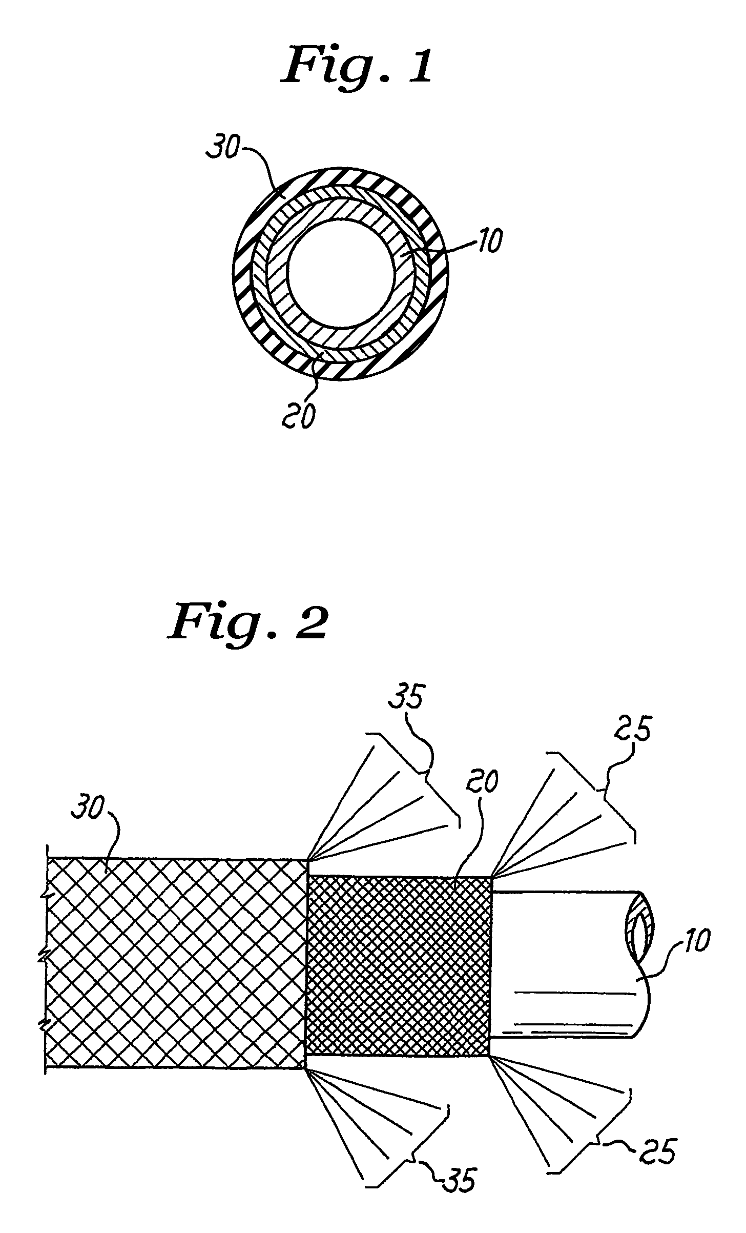 Chromatography column assembly with woven tubular mesh heater element