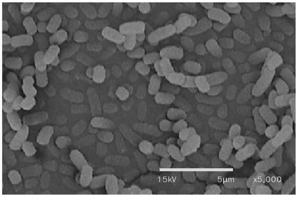 A kind of lactobacillus plantarum and application thereof