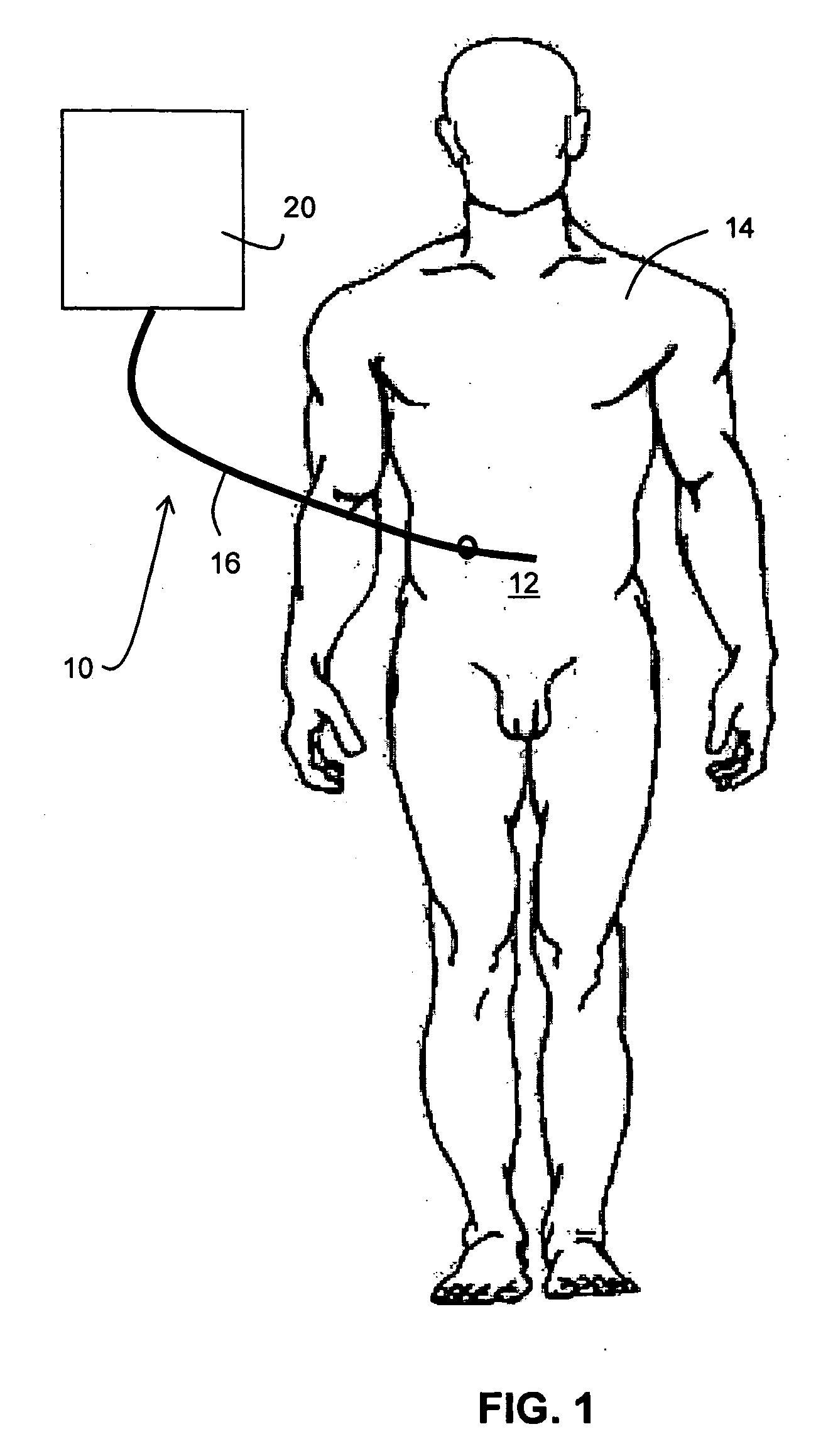 Hypothermia Devices and Methods