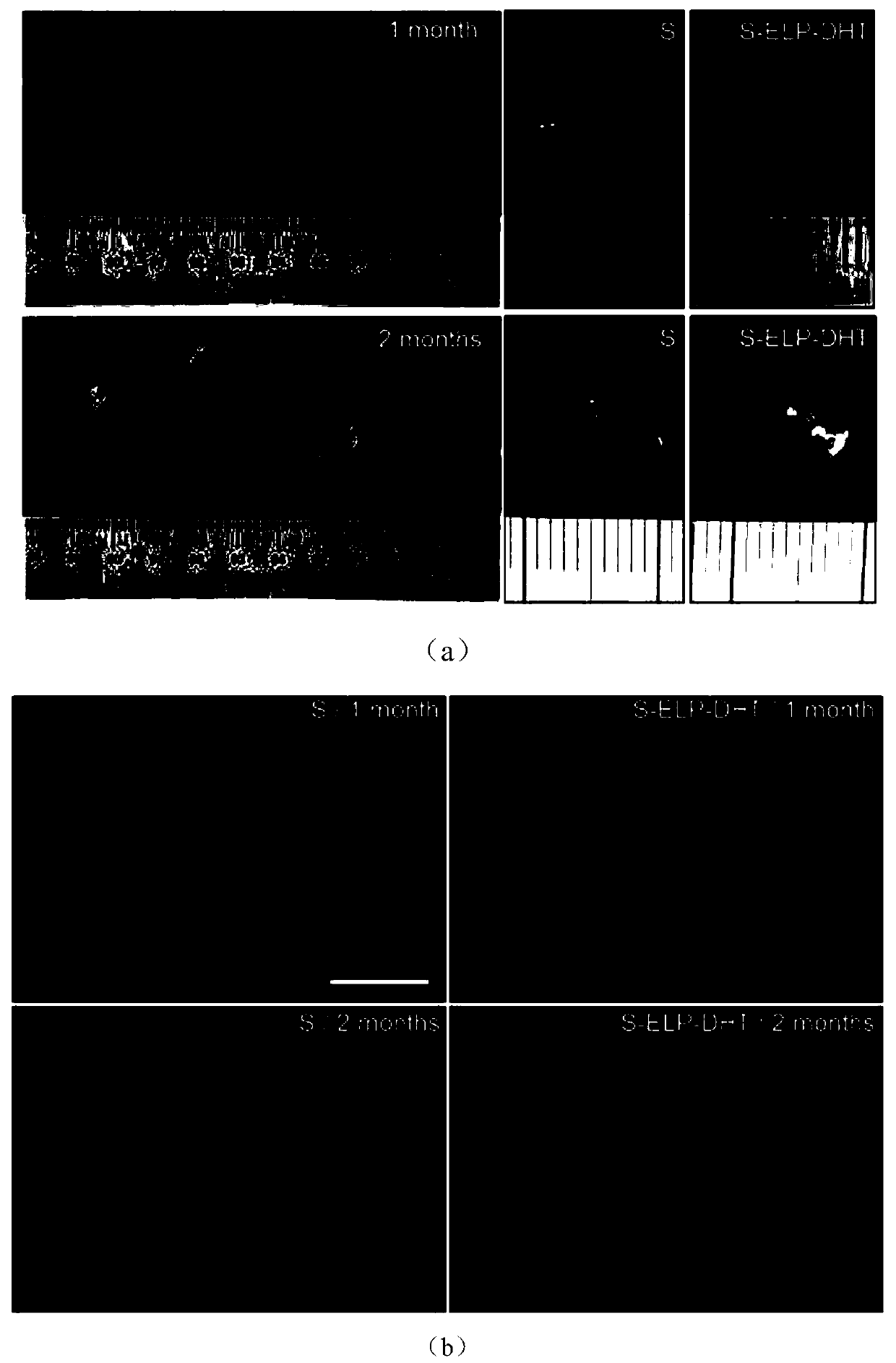 A kind of elastin-like silk fiber porous composite material and its application