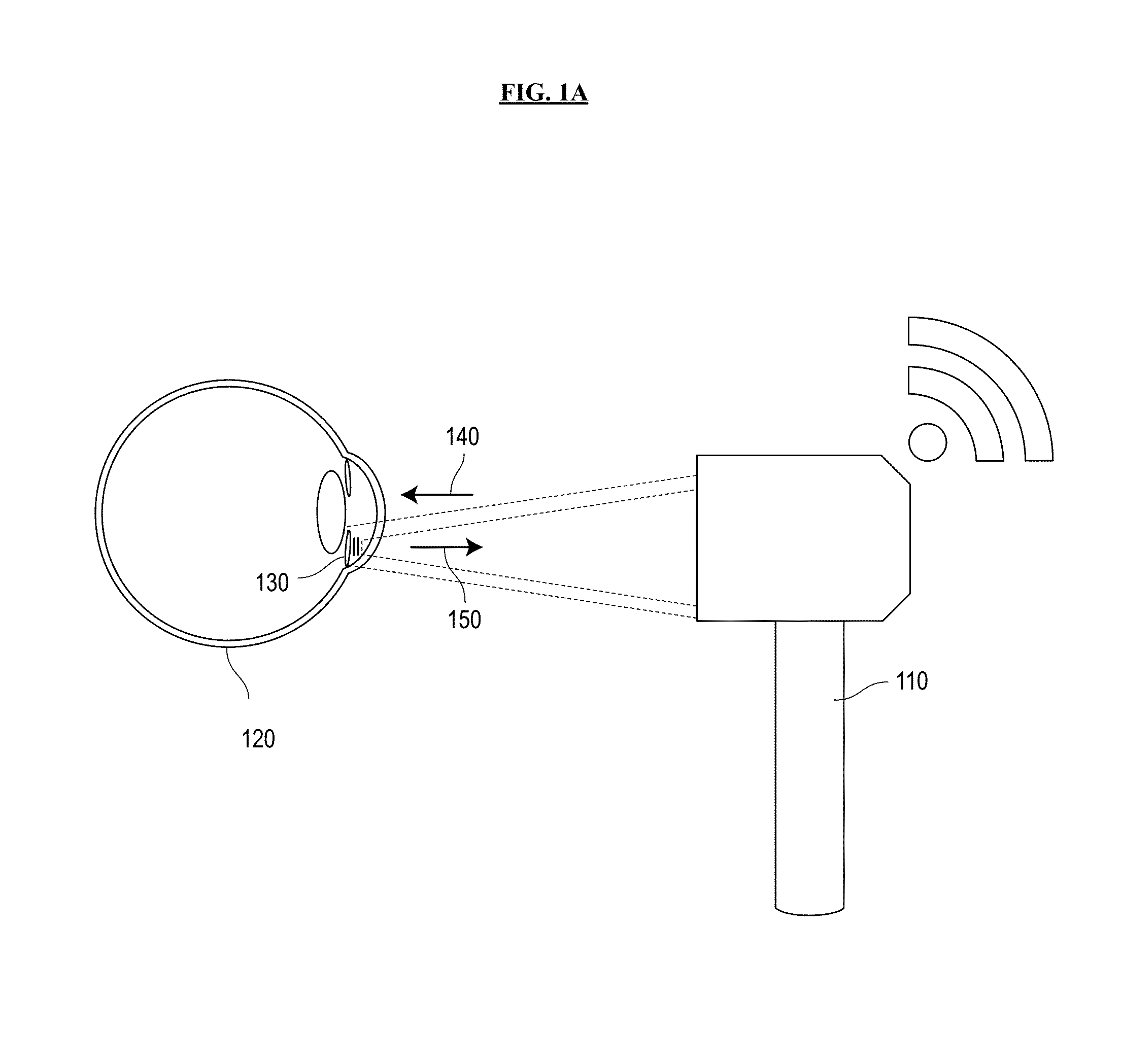 System and method for sensing intraocular pressure