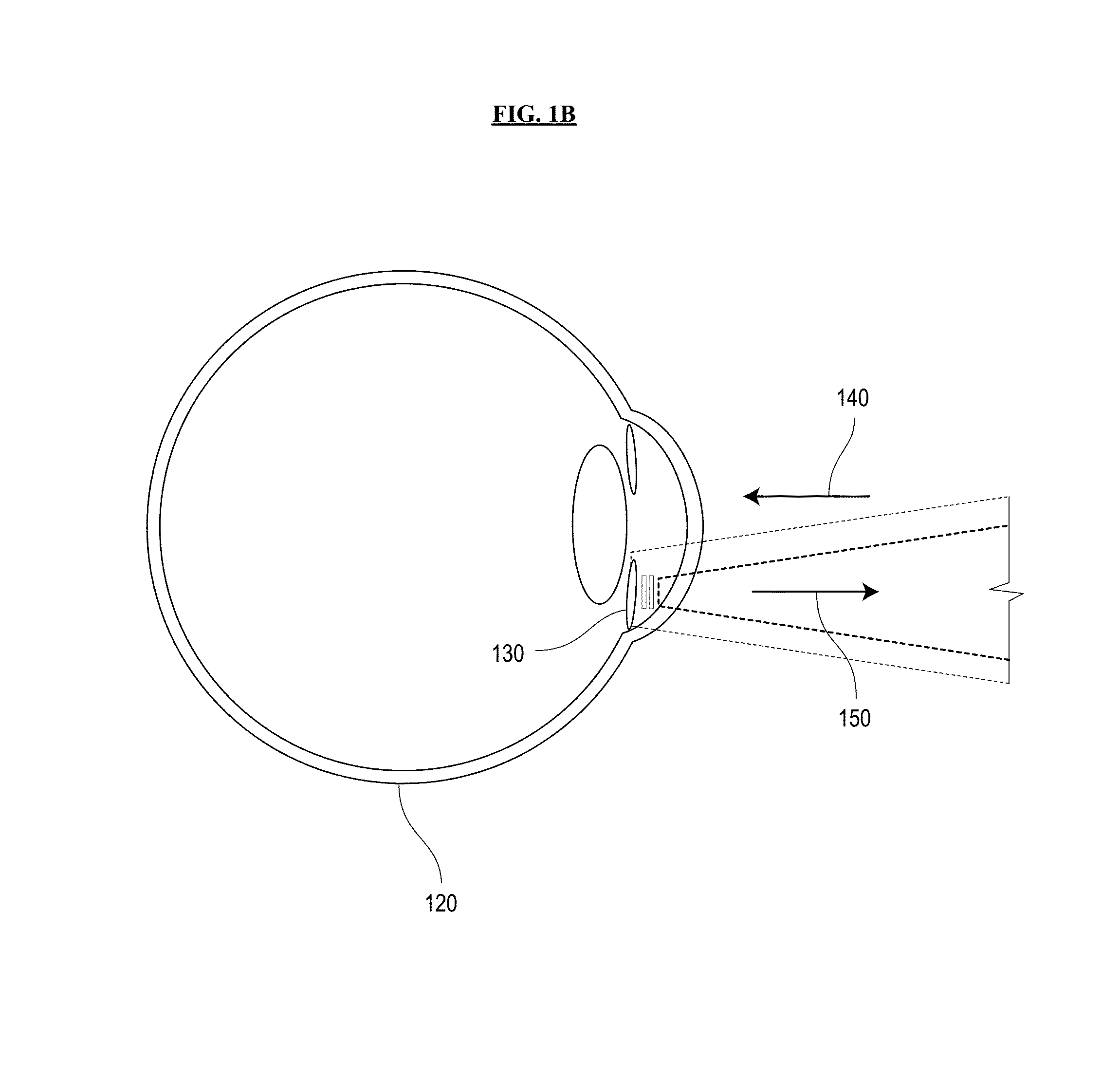 System and method for sensing intraocular pressure