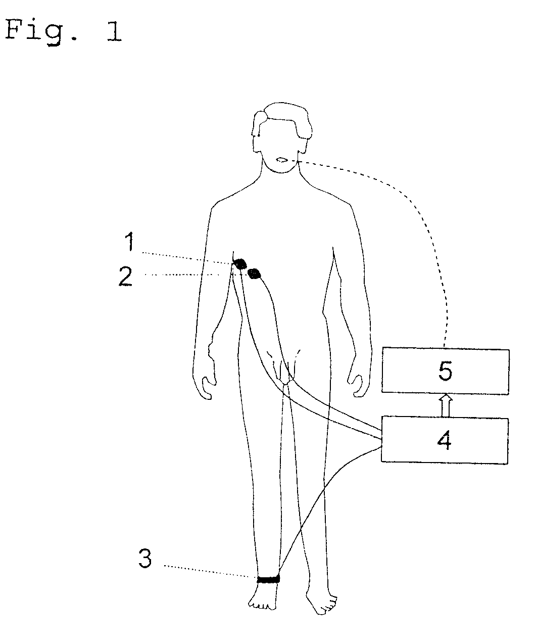 Method of automatically controlling a respiration system and a corresponding respirator