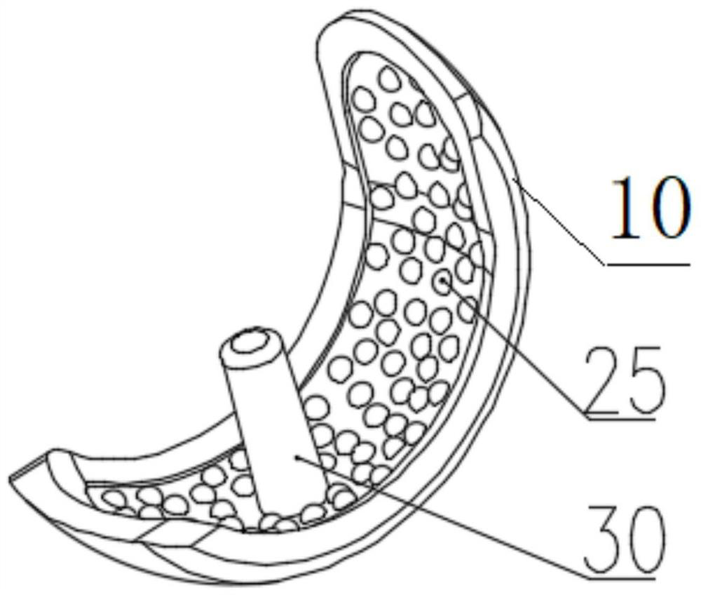 Unicondylar knee joint prosthesis