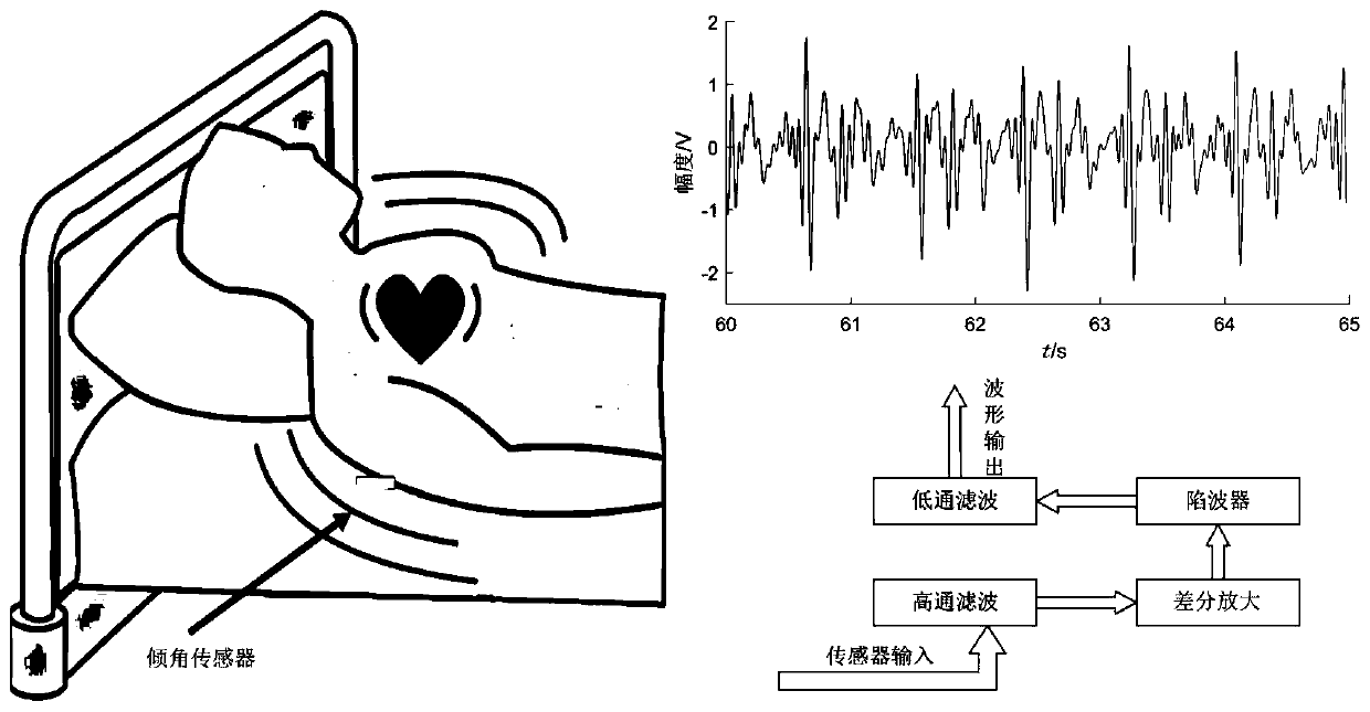 Novel peak extraction method for heart rate estimation