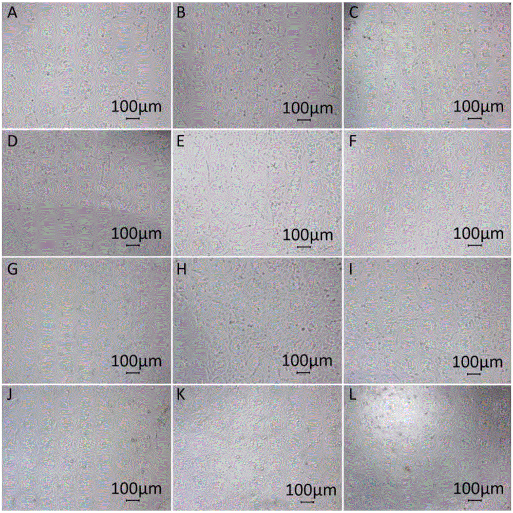 Extraction process and application of polysaccharide of grifola frondosa to preparation of medicament for repairing gastric mucosa damage