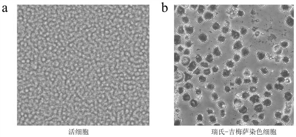 A kind of human t-lymphoblastic leukemia/lymphoma cell line and its application