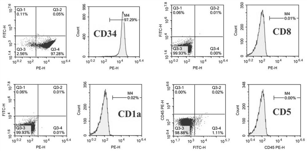 A kind of human t-lymphoblastic leukemia/lymphoma cell line and its application