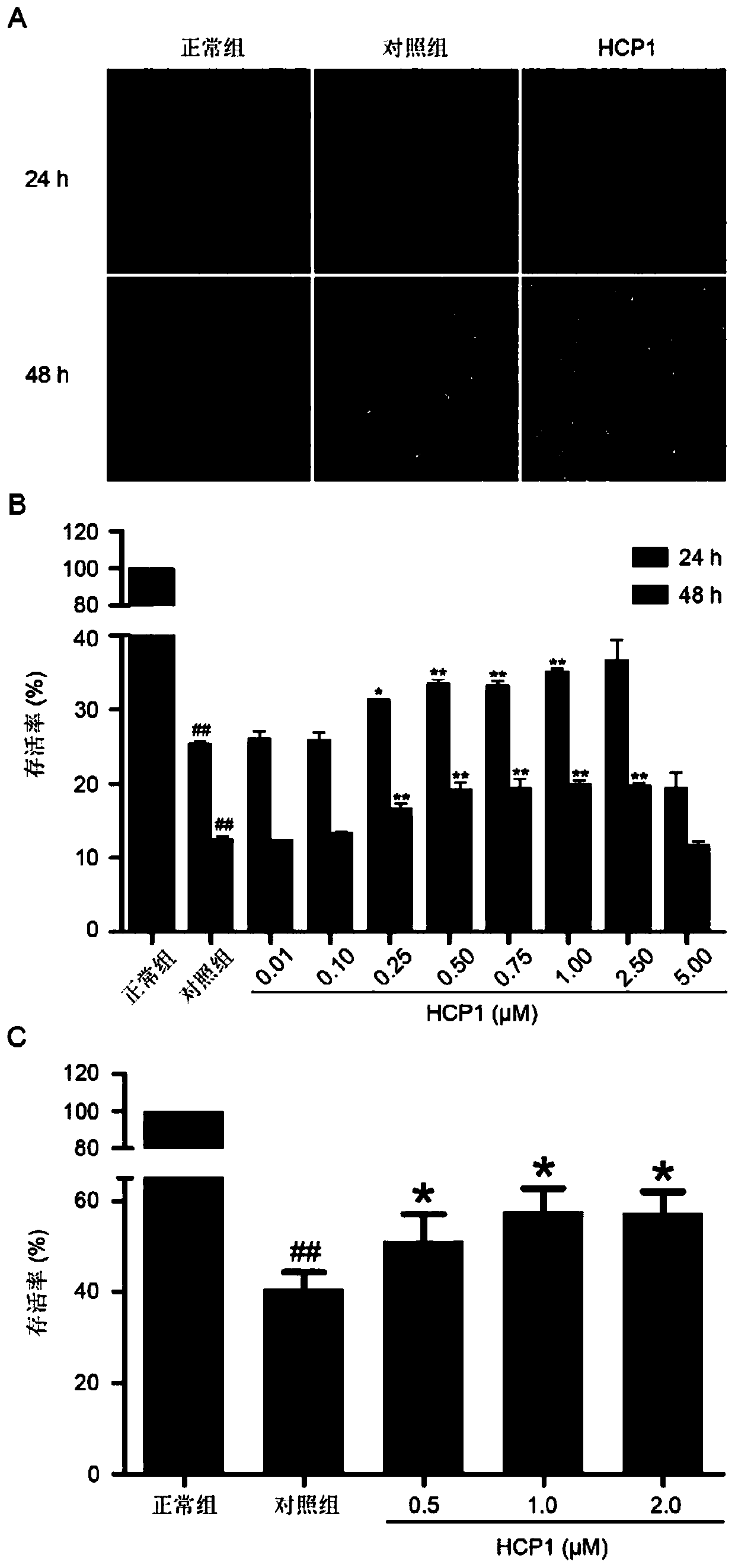 Application of 7-hydroxycoumarin pyrazoline derivatives in the preparation of drugs for stabilizing arteriosclerotic plaques