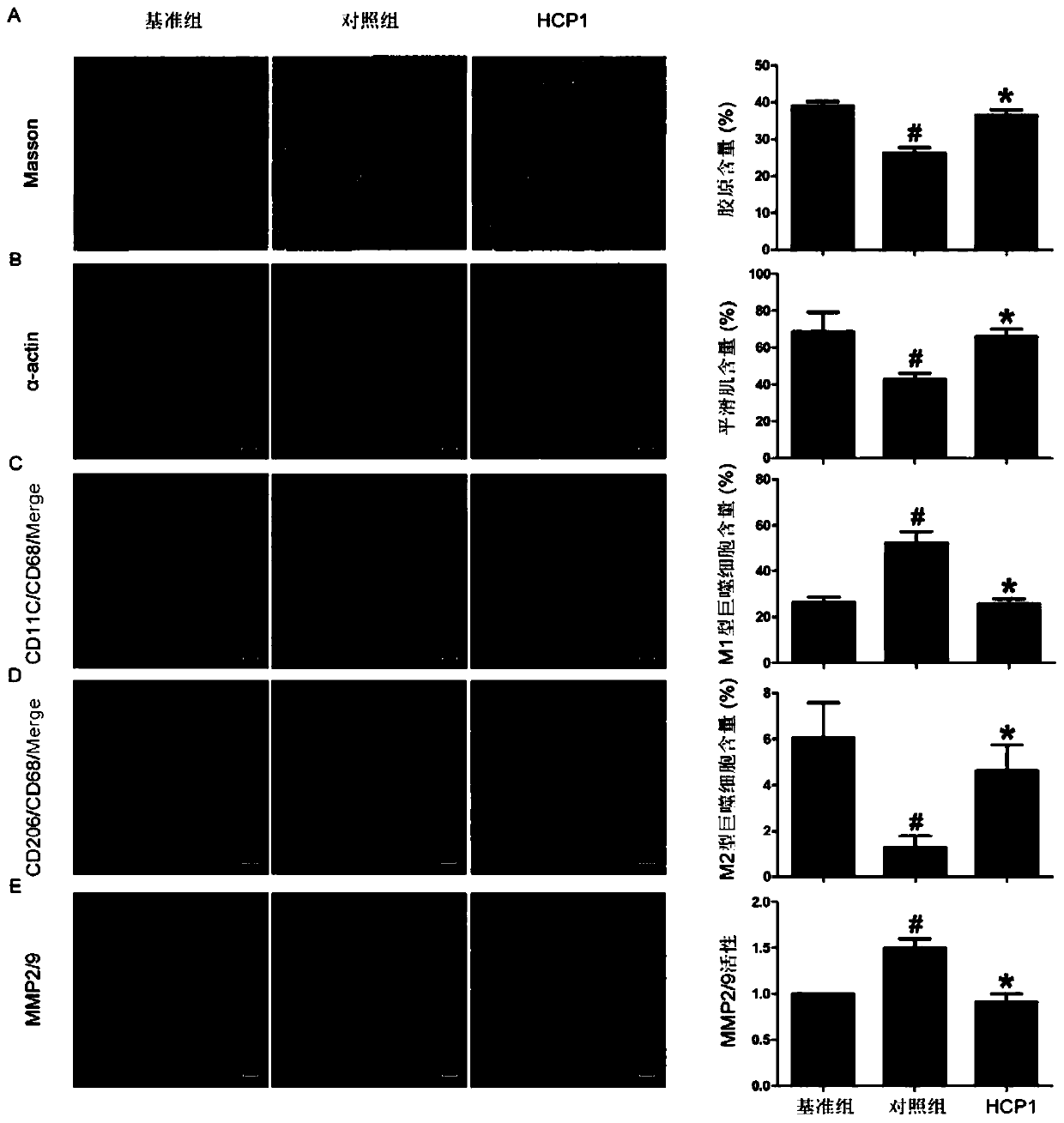 Application of 7-hydroxycoumarin pyrazoline derivatives in the preparation of drugs for stabilizing arteriosclerotic plaques