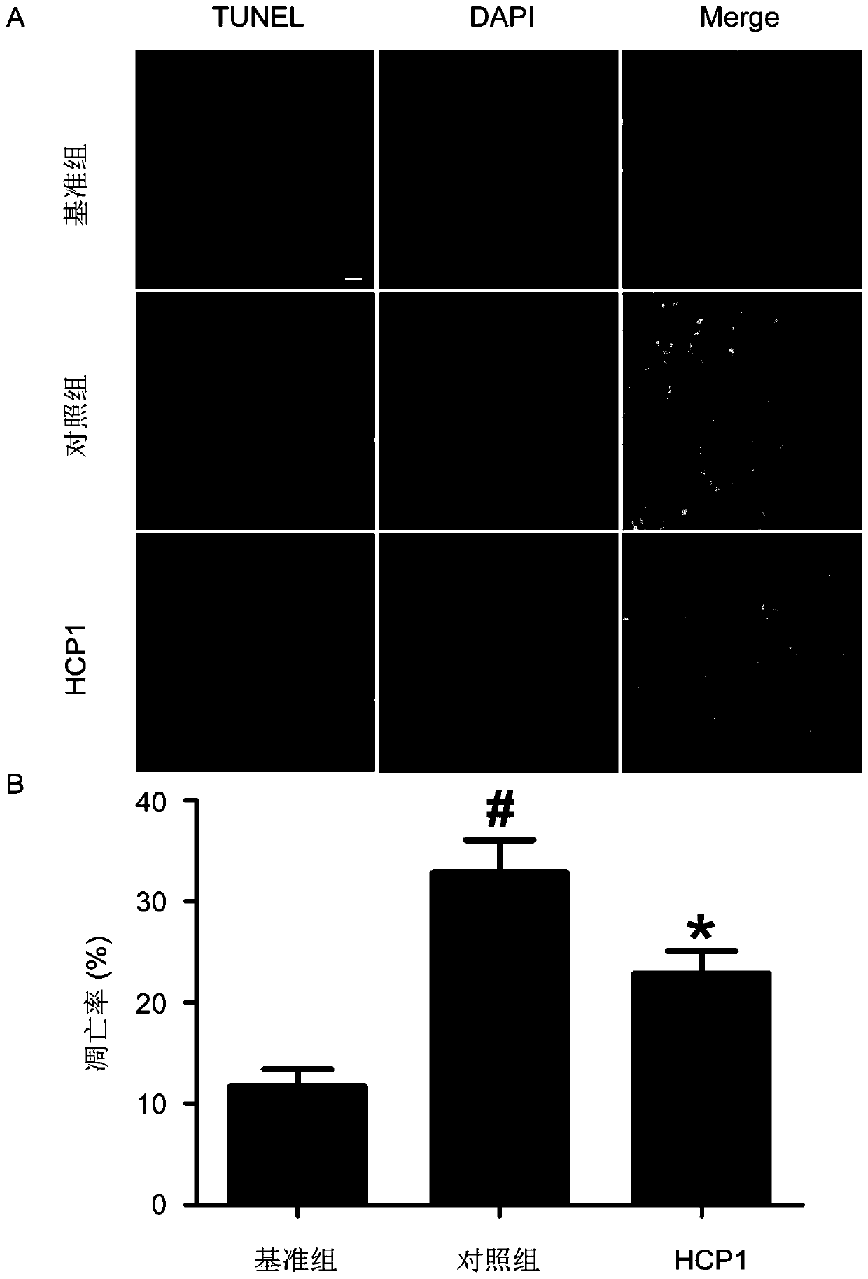 Application of 7-hydroxycoumarin pyrazoline derivatives in the preparation of drugs for stabilizing arteriosclerotic plaques