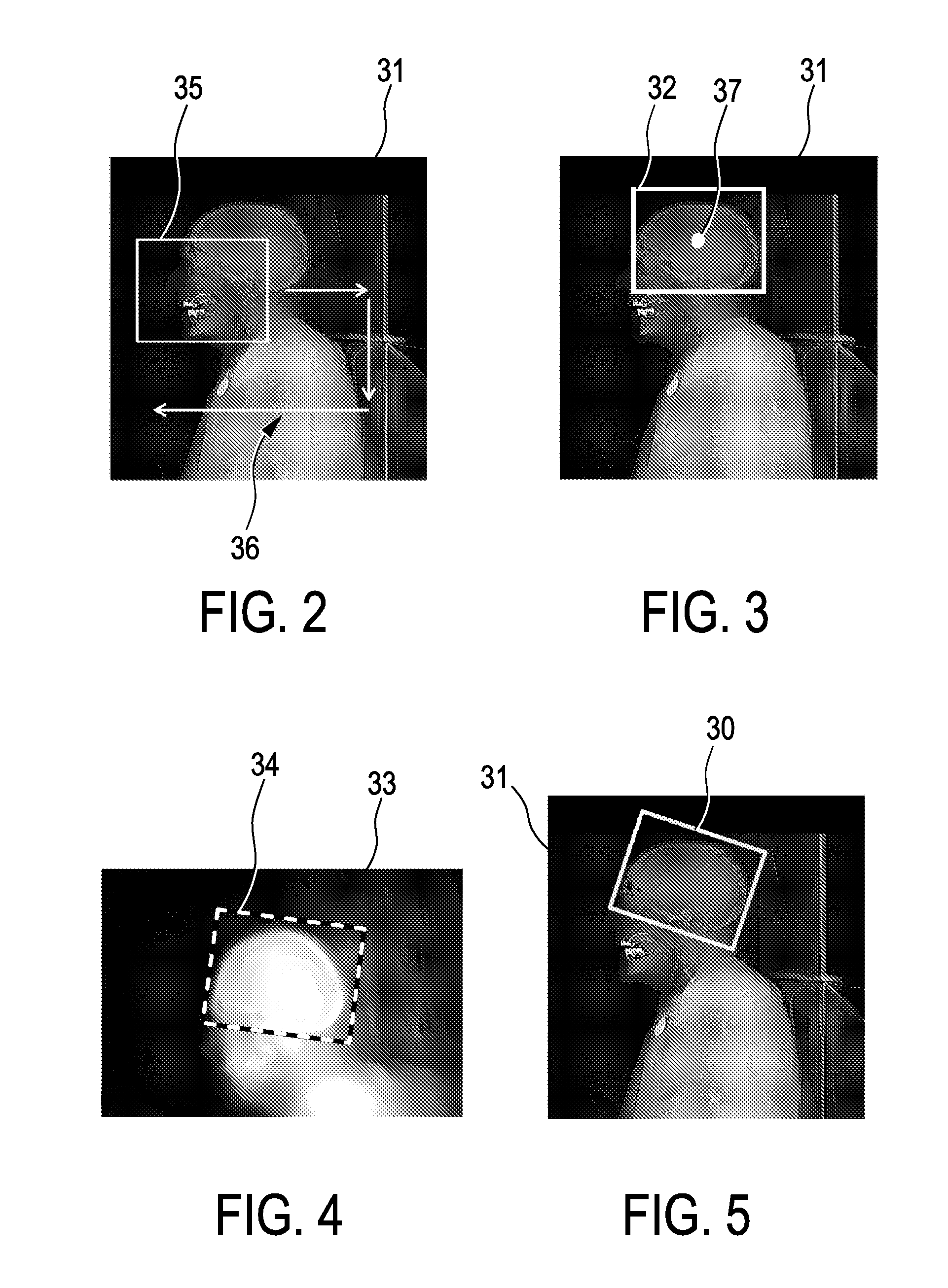 Scan region determining apparatus