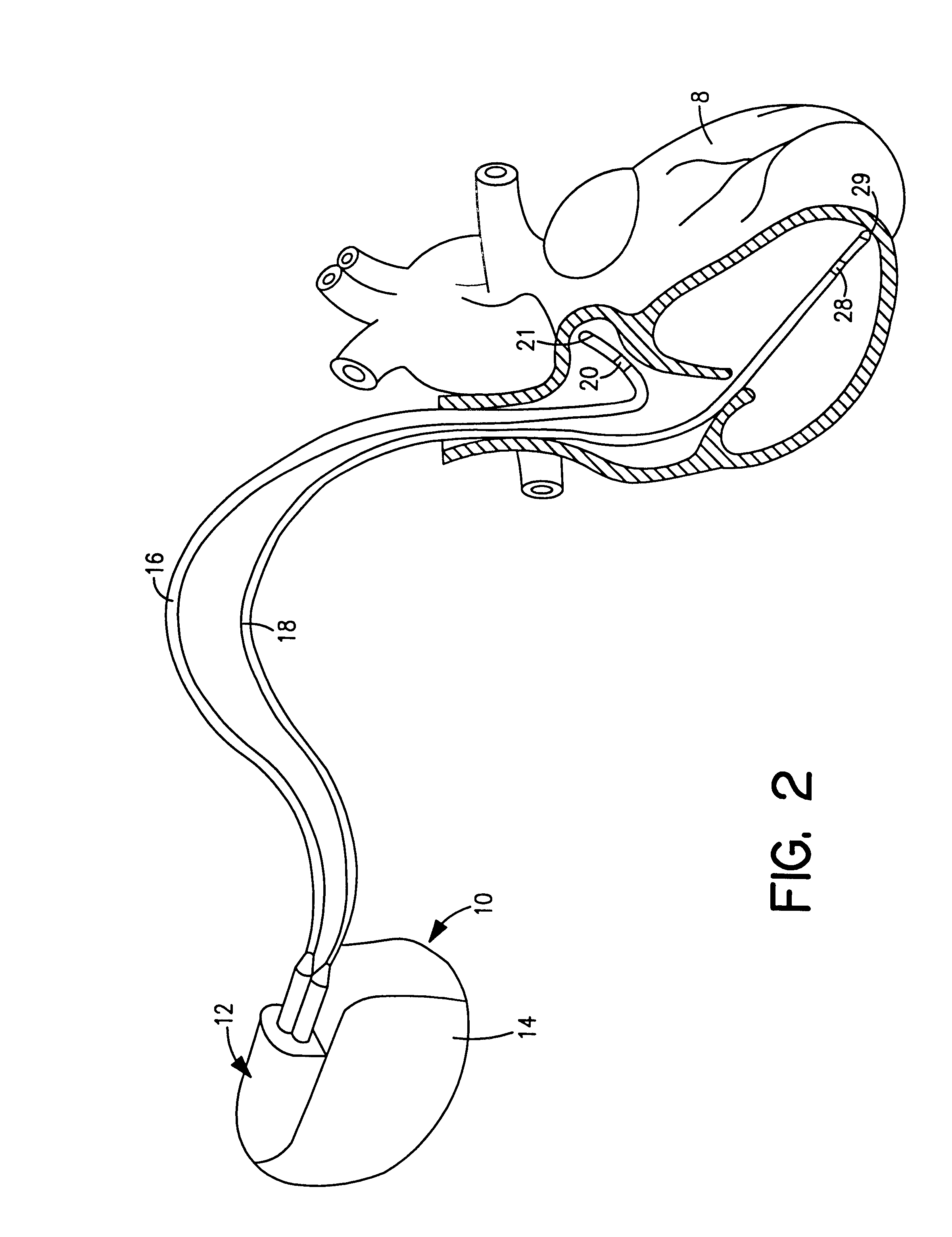 Implantable medical device programmers having headset video and methods of using same