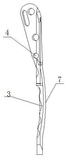 Arc-shaped steel plate for fixation of fracture of femur