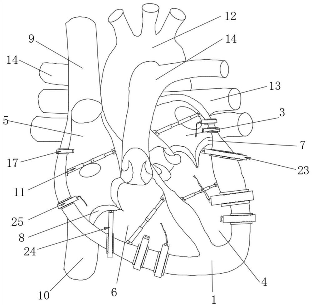 Beating device simulating heart