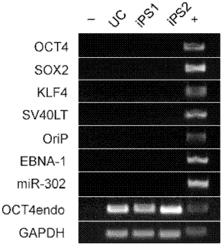 Thalassemia-induced multipotent stem cell as well as preparation method and application thereof