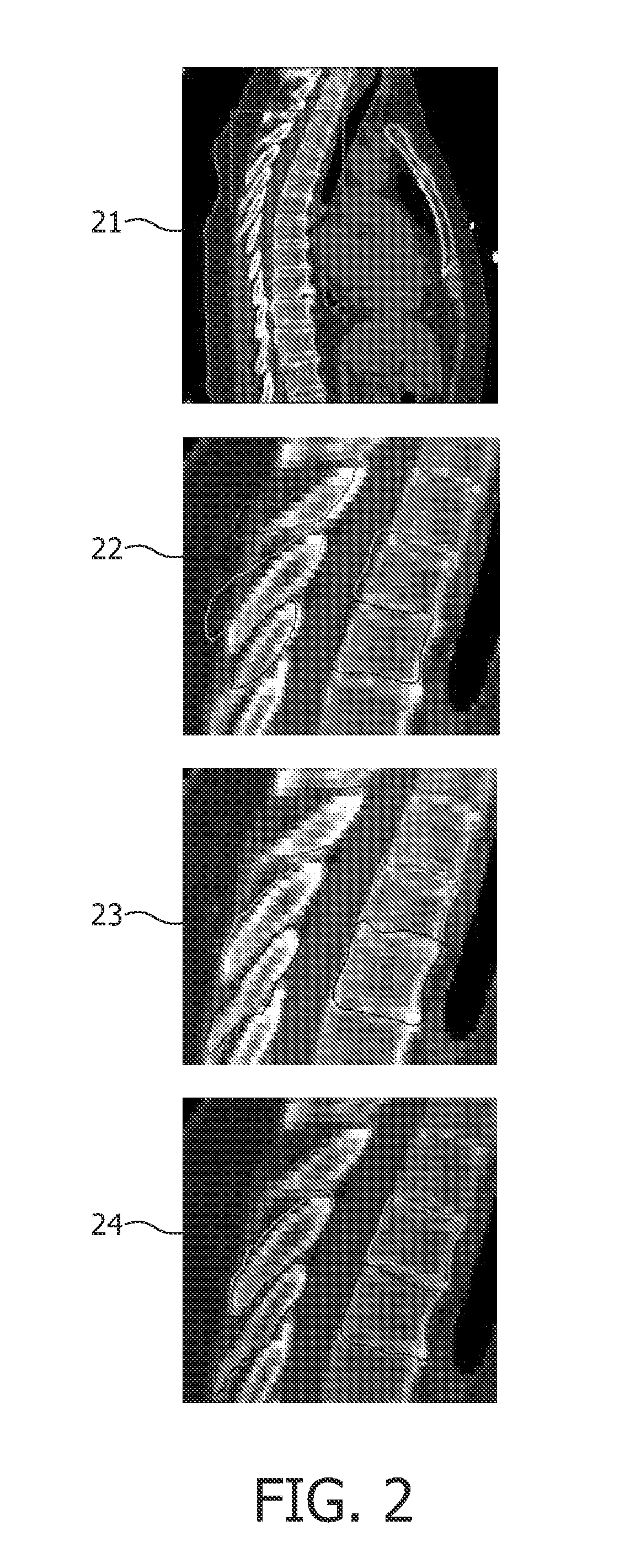 Mesh collision avoidance