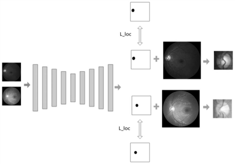 Fundus image optic cup and optic disk segmentation method