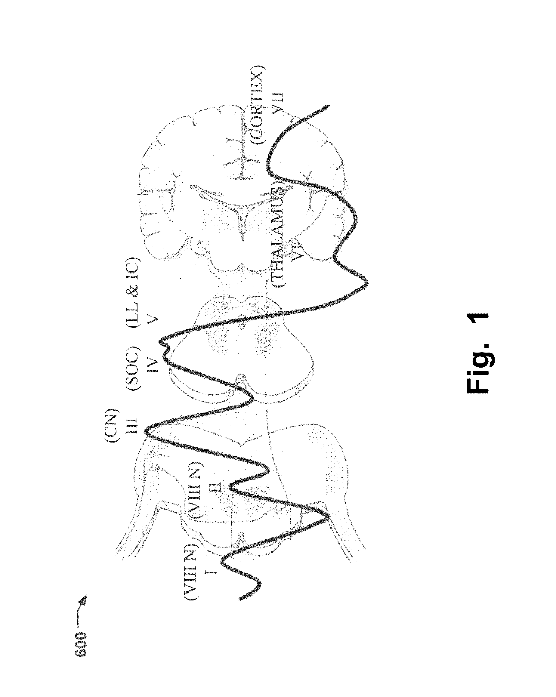 Method And System For Monitoring Depth Of Anaesthesia And Sensory Functioning