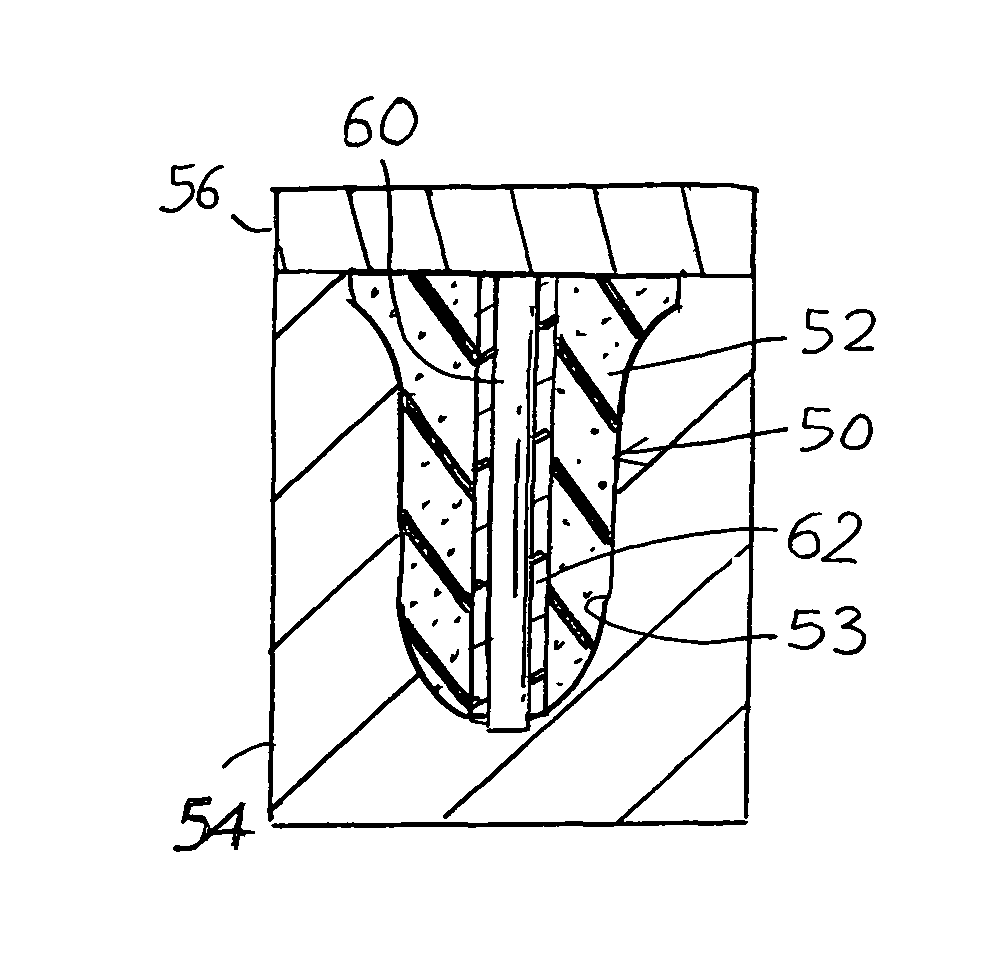 Method of forming an in-ear device