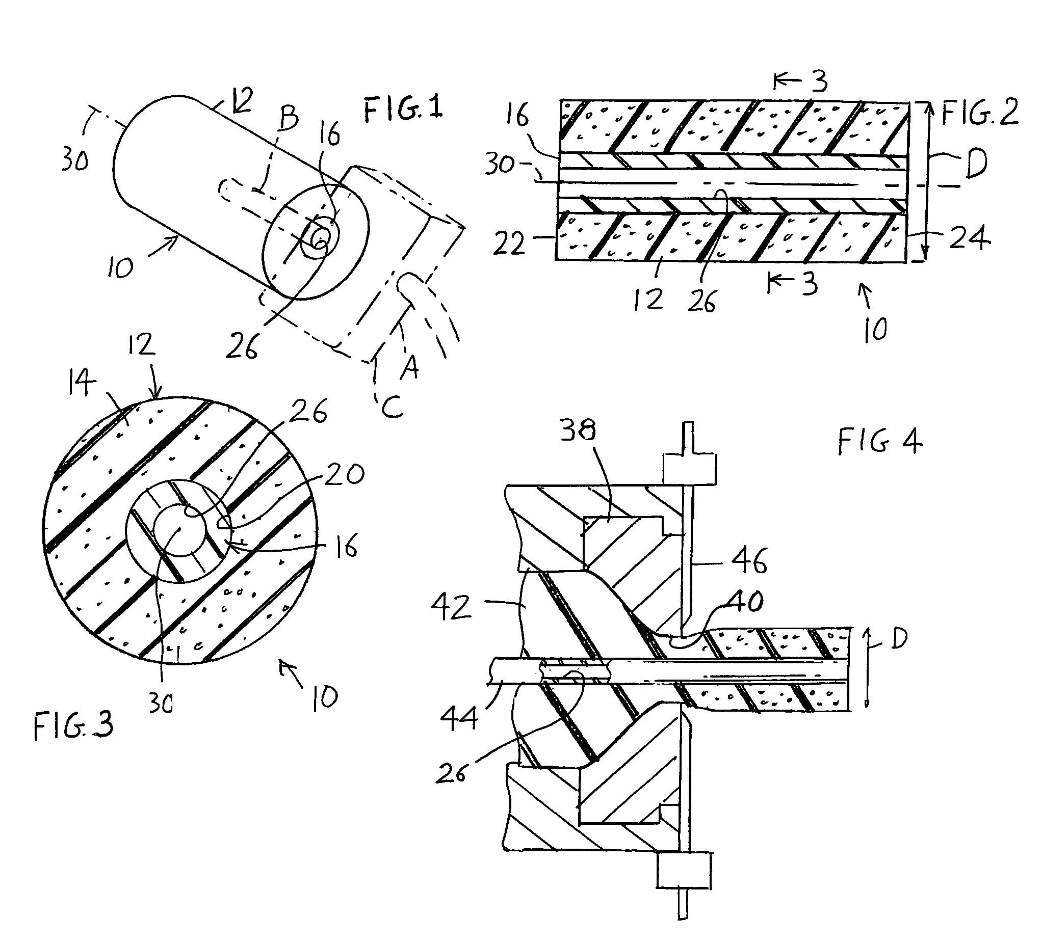 Method of forming an in-ear device